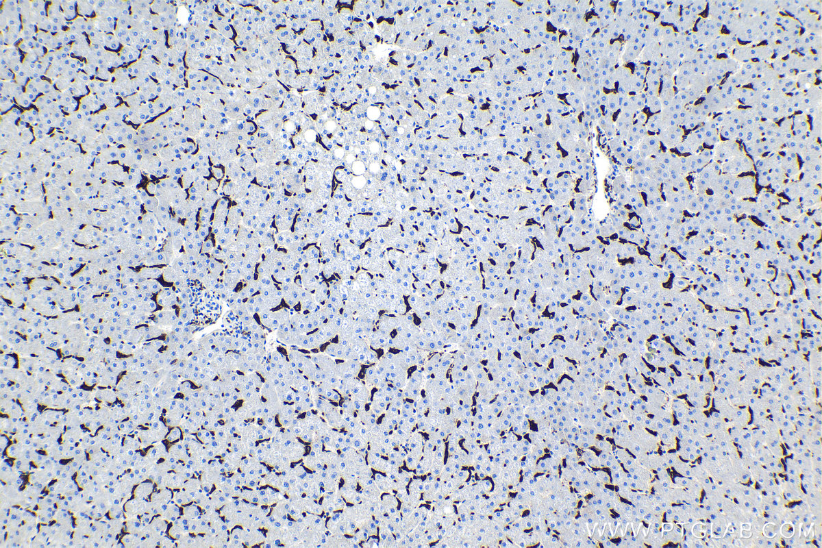 Immunohistochemistry (IHC) staining of human liver tissue using CD163 Monoclonal antibody (68218-1-Ig)