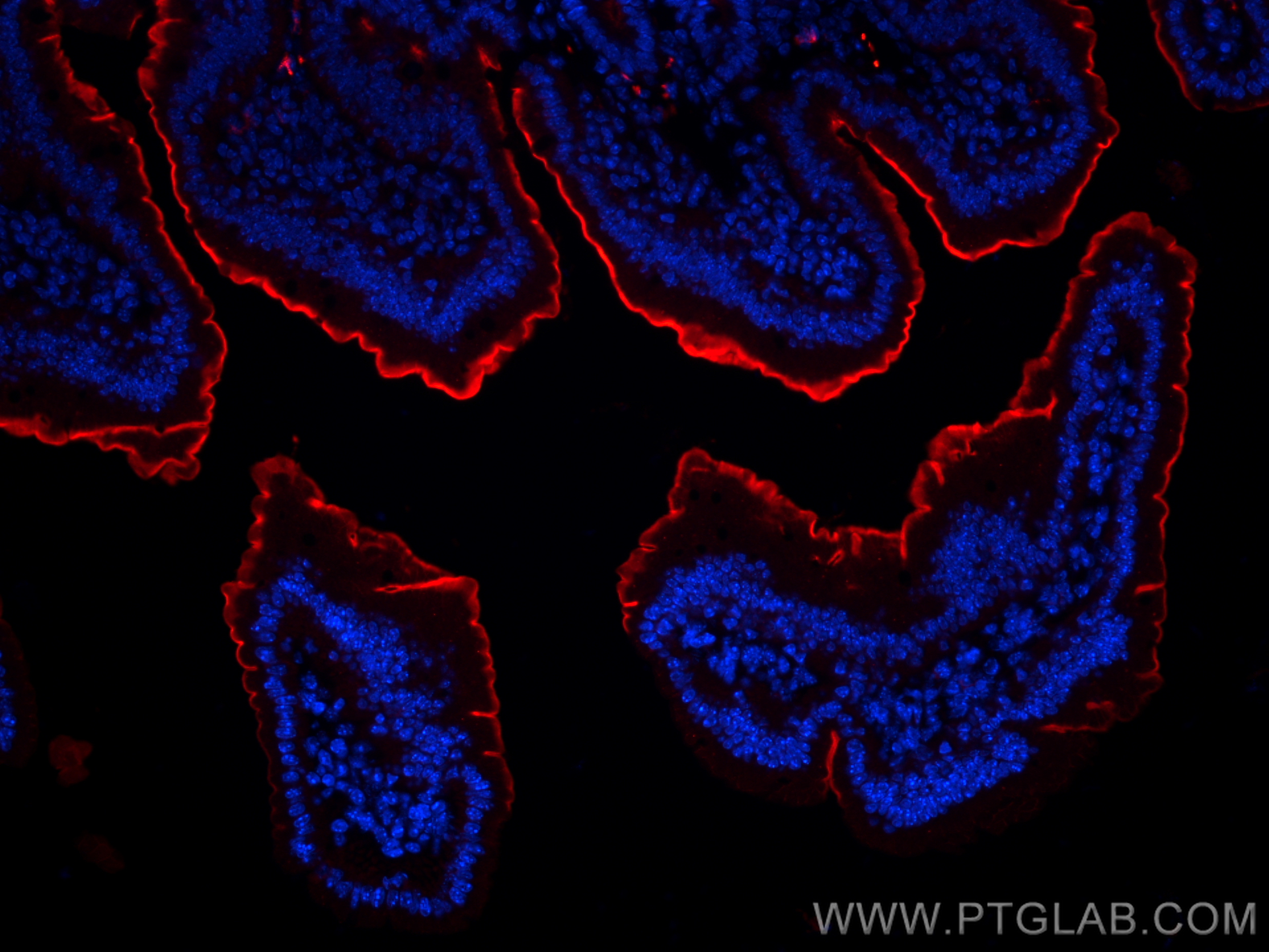 Immunofluorescence (IF) / fluorescent staining of mouse small intestine tissue using CD163 Recombinant antibody (83285-4-RR)