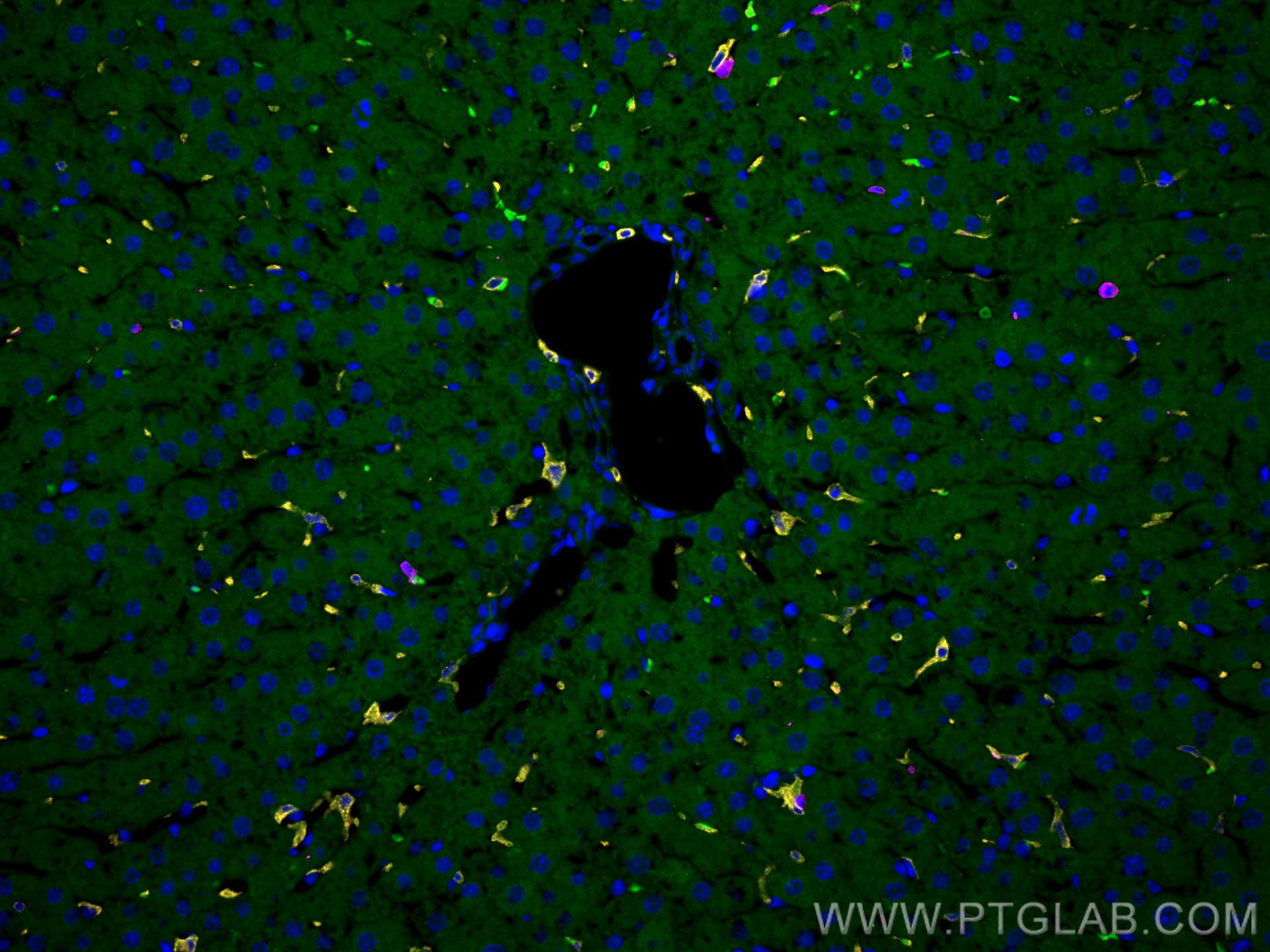 Immunofluorescence (IF) / fluorescent staining of rat liver tissue using CD163 Recombinant antibody (83285-4-RR)