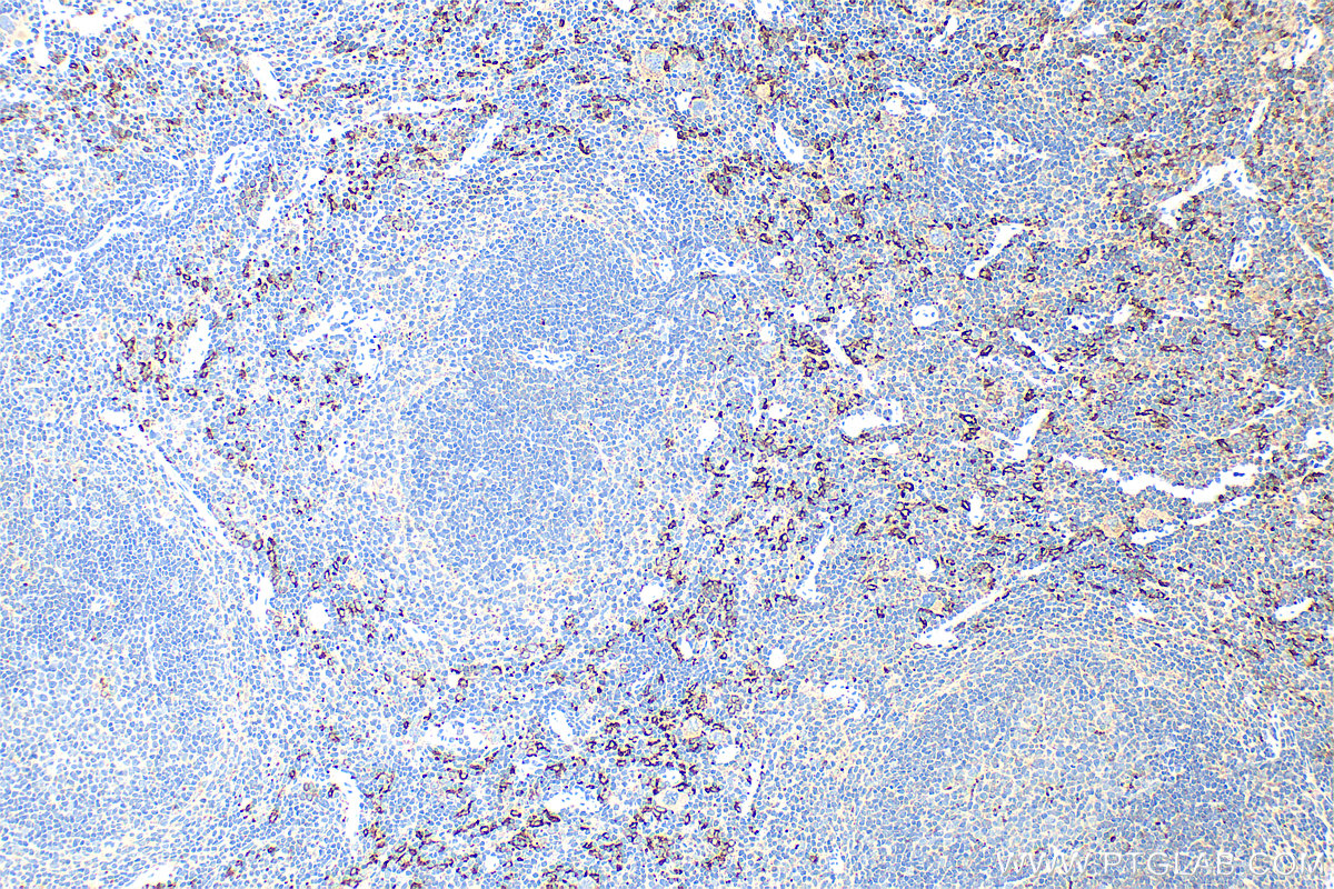 Immunohistochemistry (IHC) staining of mouse spleen tissue using CD163 Recombinant antibody (83285-4-RR)