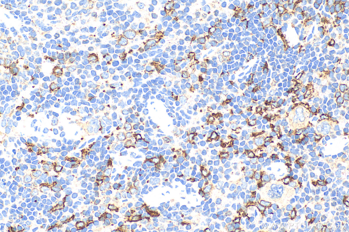 Immunohistochemistry (IHC) staining of mouse spleen tissue using CD163 Recombinant antibody (83285-4-RR)