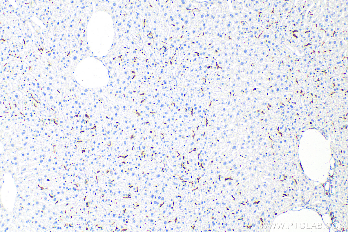 Immunohistochemistry (IHC) staining of mouse liver tissue using CD163 Recombinant antibody (83285-4-RR)