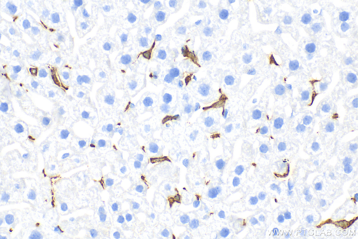 Immunohistochemistry (IHC) staining of mouse liver tissue using CD163 Recombinant antibody (83285-4-RR)