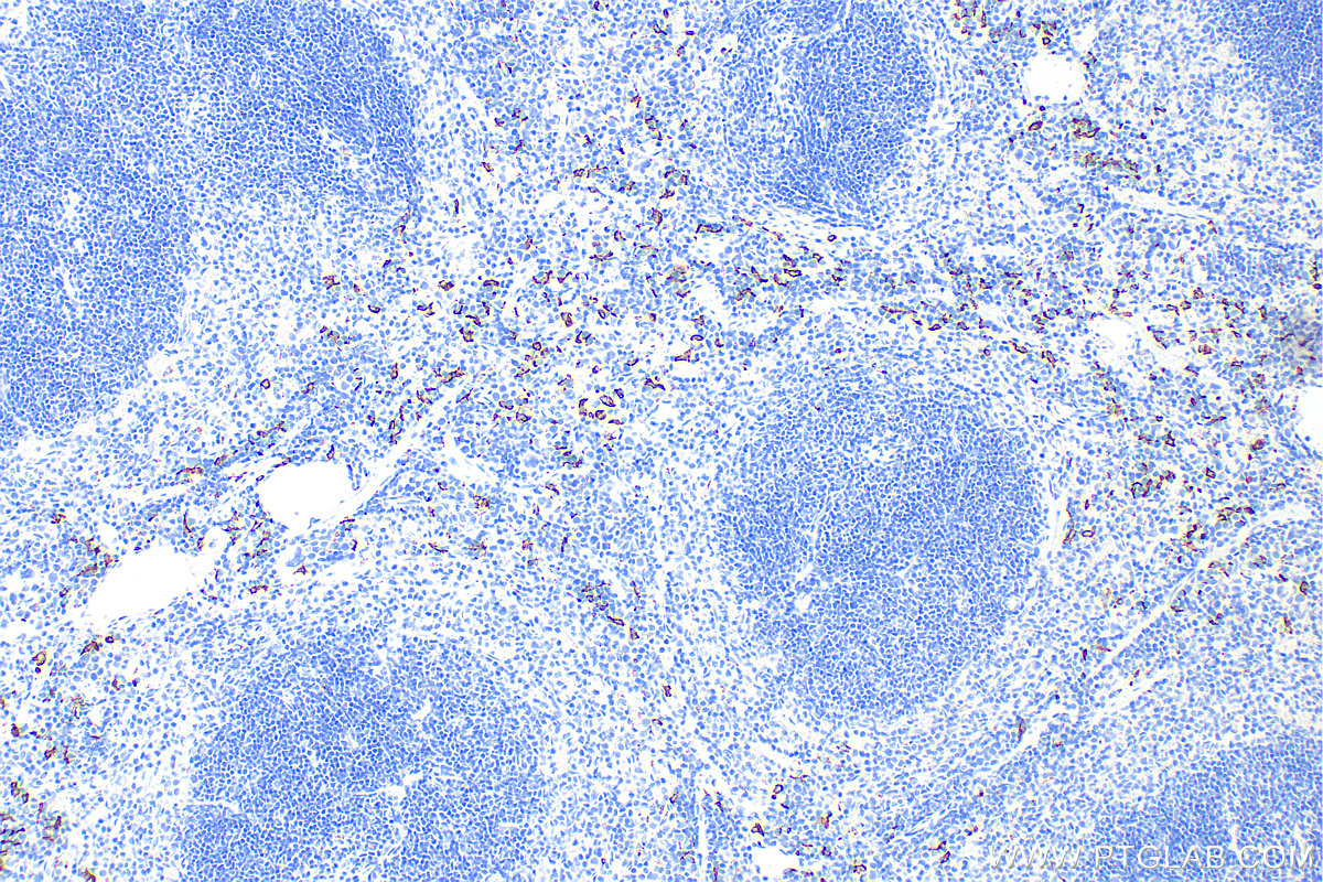 Immunohistochemistry (IHC) staining of mouse spleen tissue using CD163 Recombinant antibody (83285-4-RR)