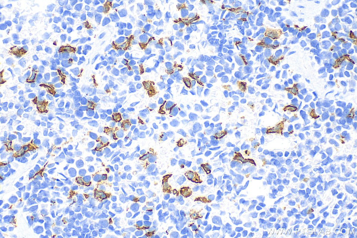 Immunohistochemistry (IHC) staining of mouse spleen tissue using CD163 Recombinant antibody (83285-4-RR)