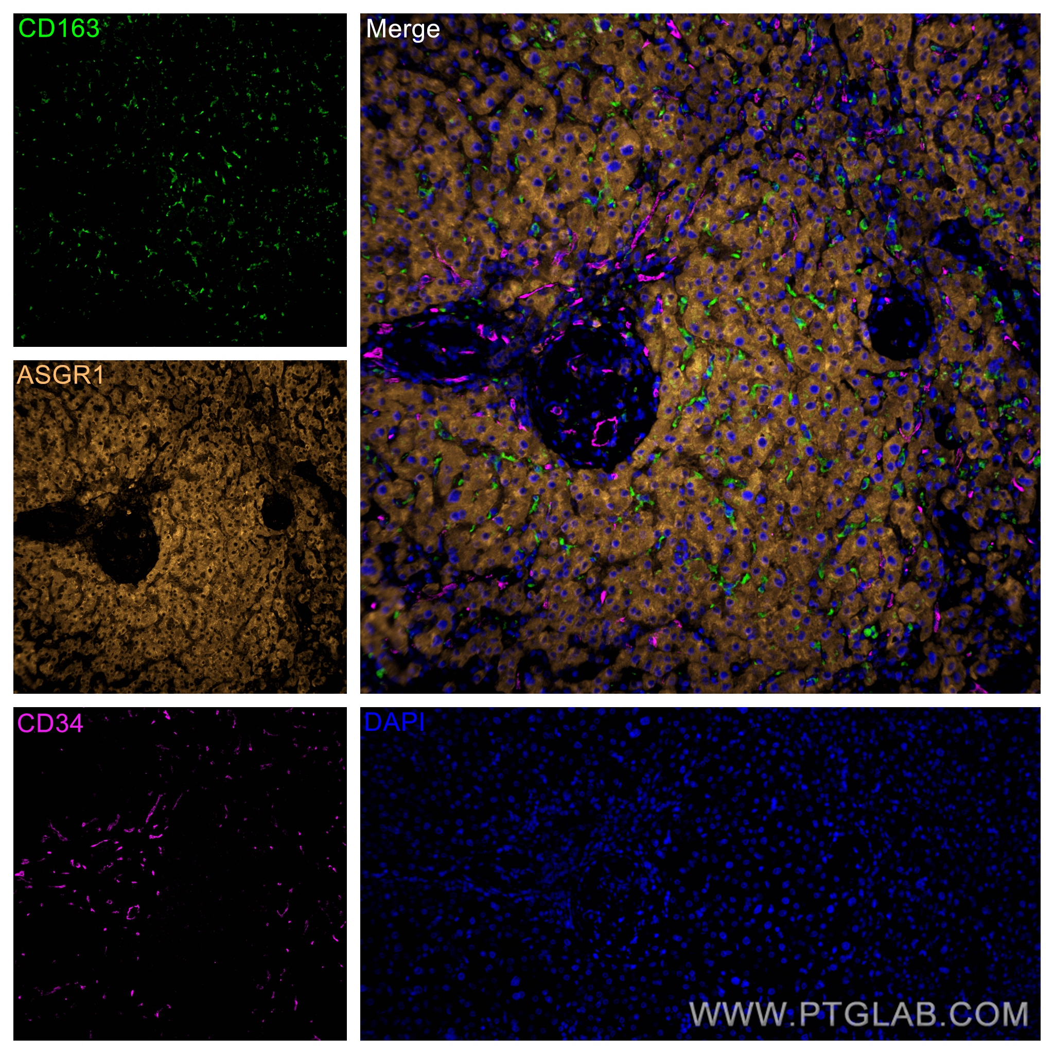 Immunofluorescence (IF) / fluorescent staining of human liver tissue using CoraLite® Plus 488-conjugated CD163 Polyclonal ant (CL488-16646)