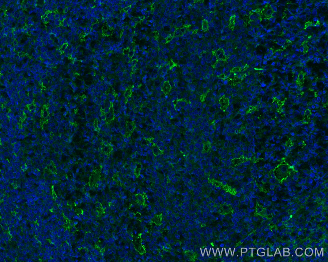 Immunofluorescence (IF) / fluorescent staining of human tonsillitis tissue using CD18 Polyclonal antibody (10554-1-AP)