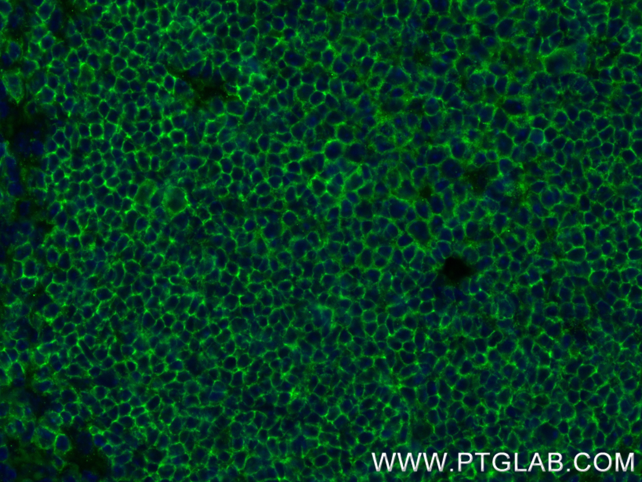 Immunofluorescence (IF) / fluorescent staining of mouse spleen tissue using CD19 Recombinant antibody (83254-1-RR)