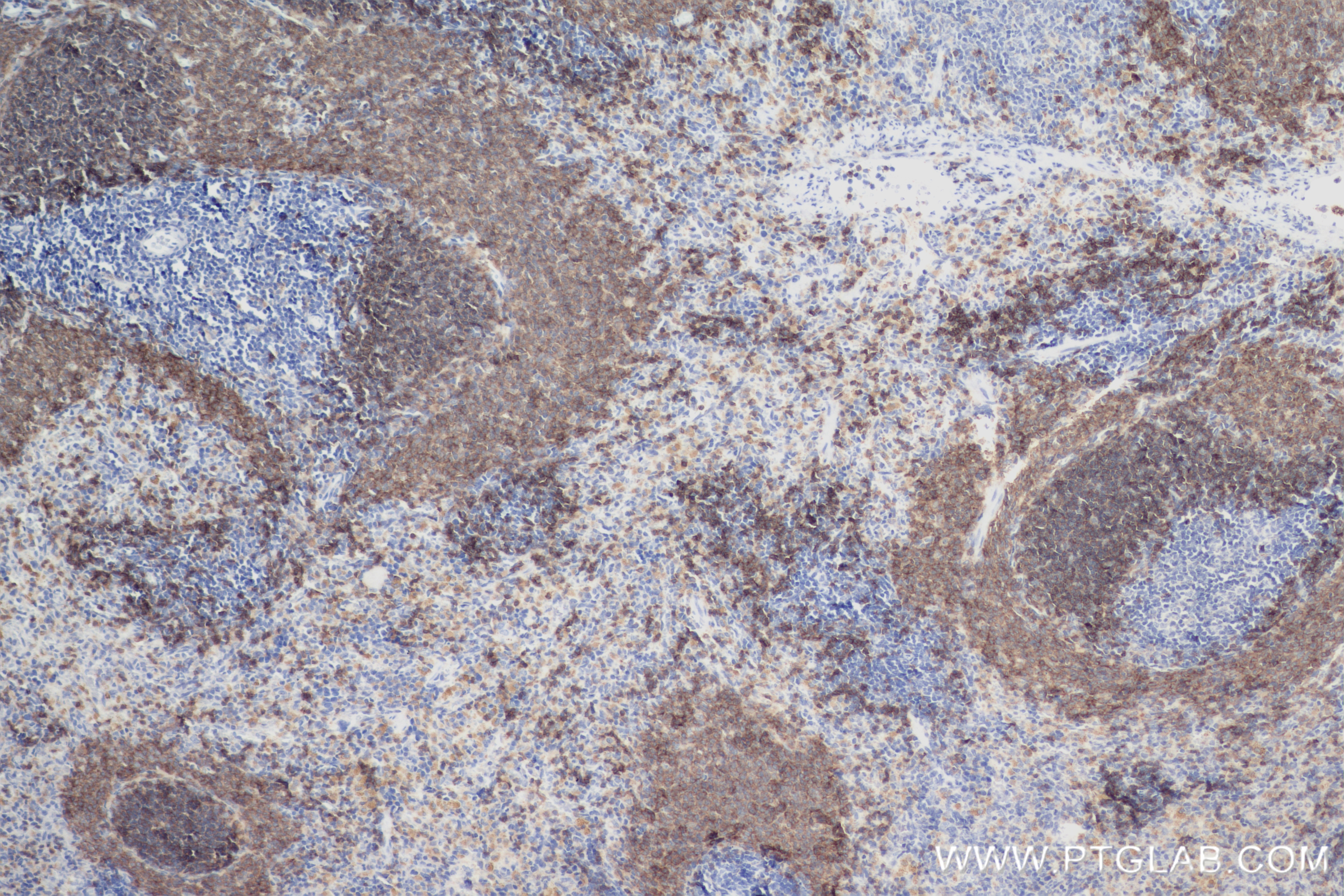 Immunohistochemistry (IHC) staining of rat spleen tissue using CD19 Recombinant antibody (83254-1-RR)