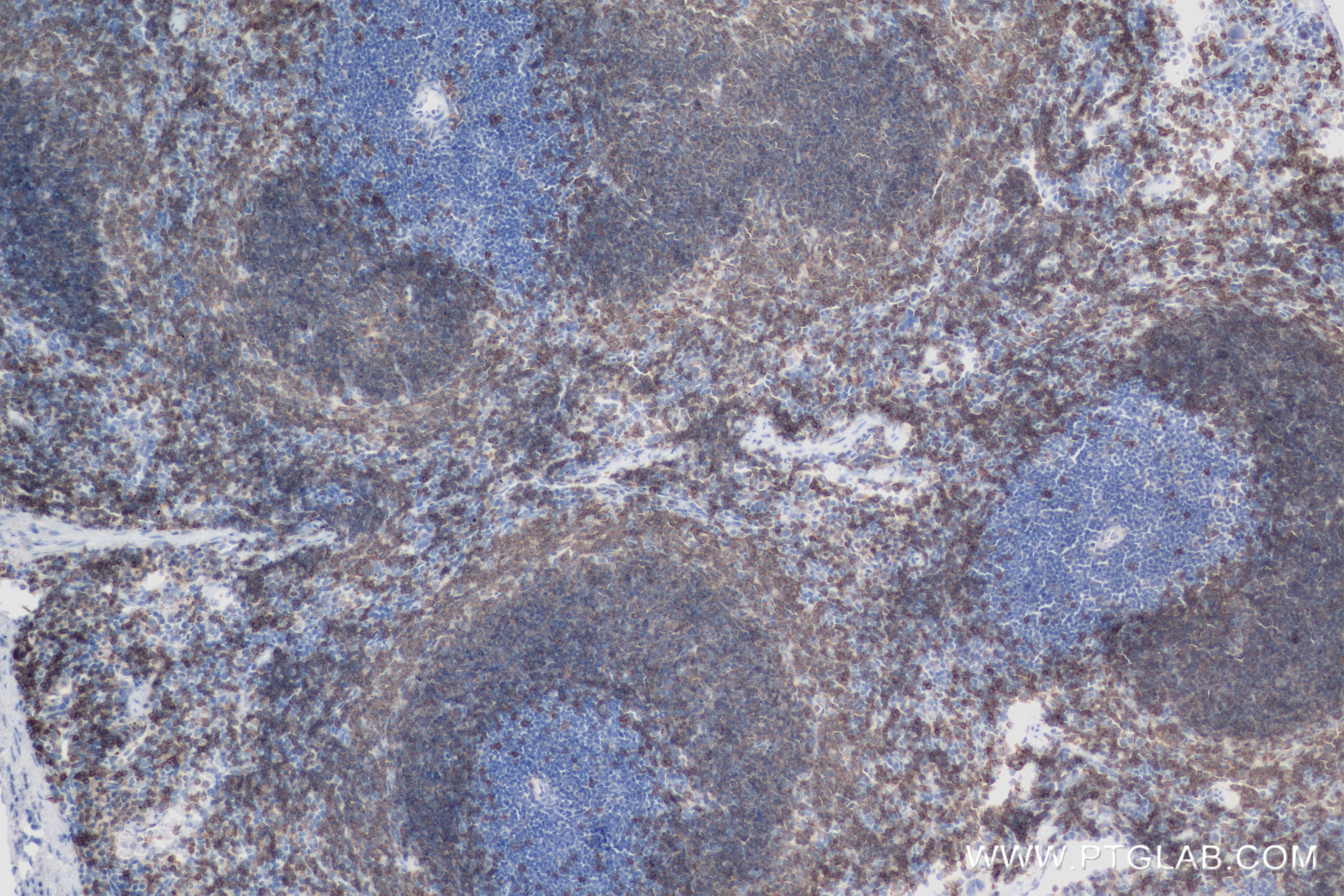 Immunohistochemistry (IHC) staining of mouse spleen tissue using CD19 Recombinant antibody (83254-1-RR)