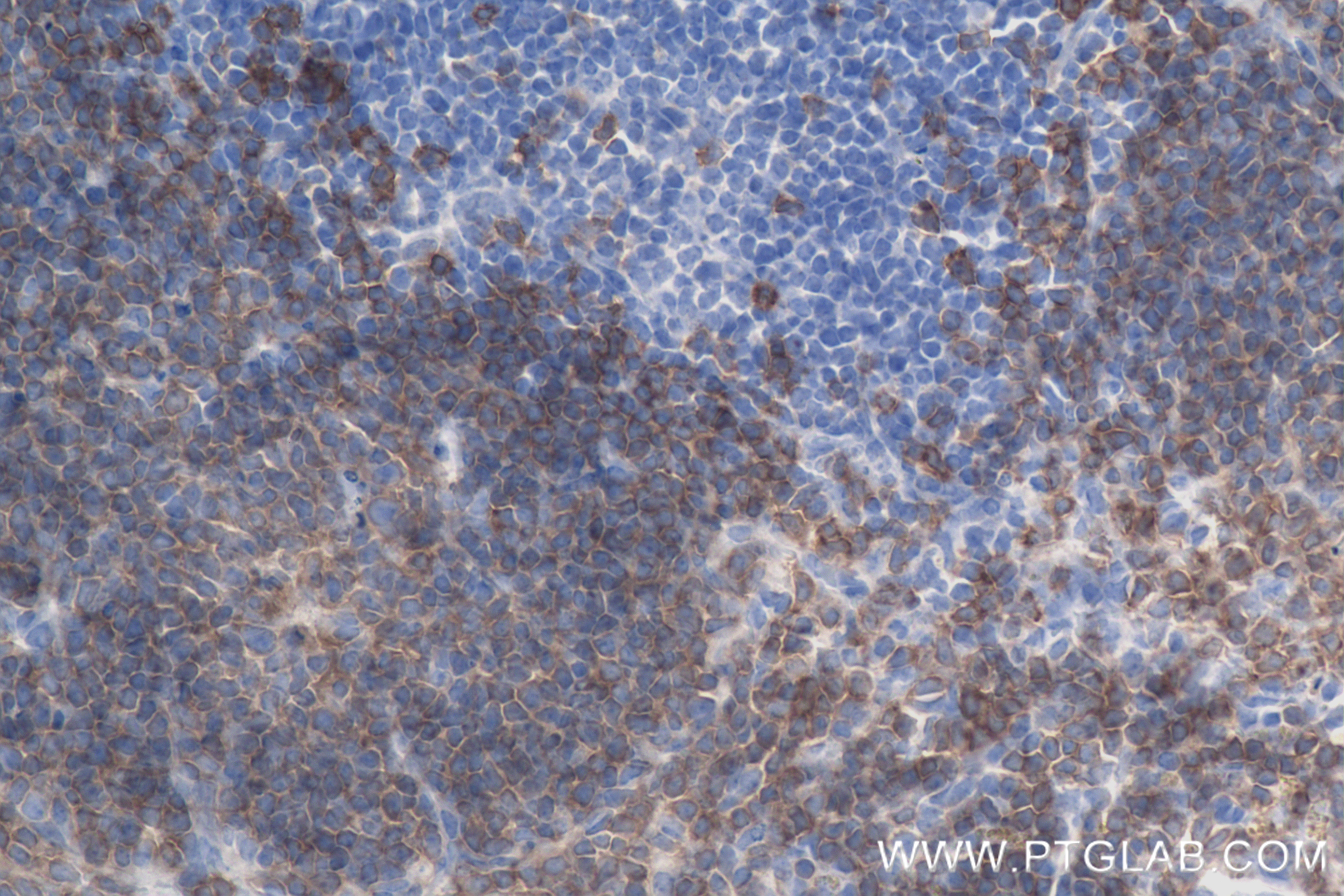 Immunohistochemistry (IHC) staining of mouse spleen tissue using CD19 Recombinant antibody (83254-1-RR)