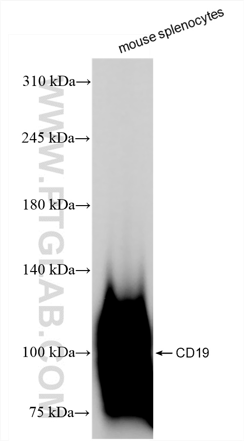 Western Blot (WB) analysis of mouse splenocytes using CD19 Recombinant antibody (84848-5-RR)