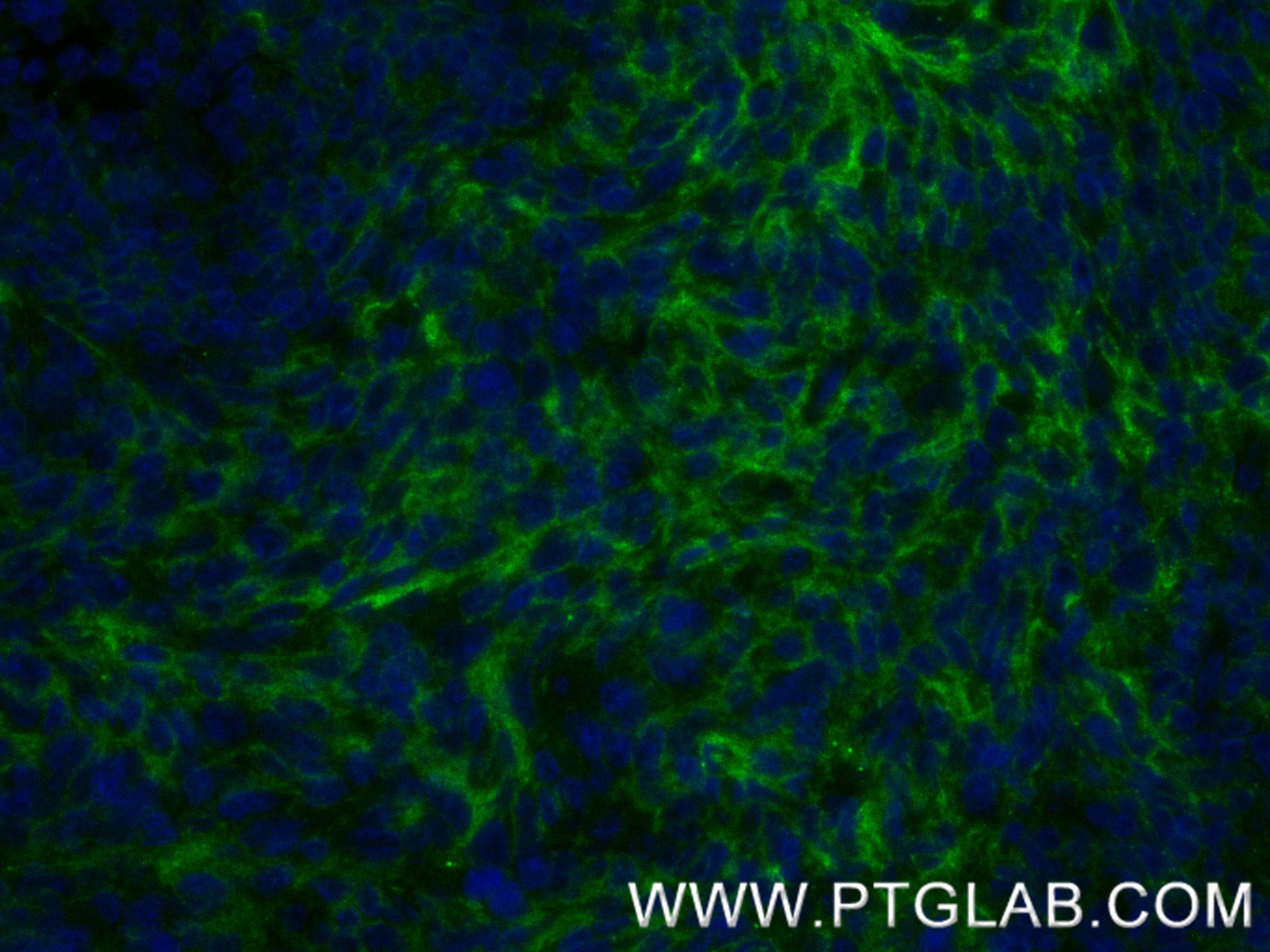 Immunofluorescence (IF) / fluorescent staining of human tonsillitis tissue using CD19 Recombinant antibody (86116-1-RR)