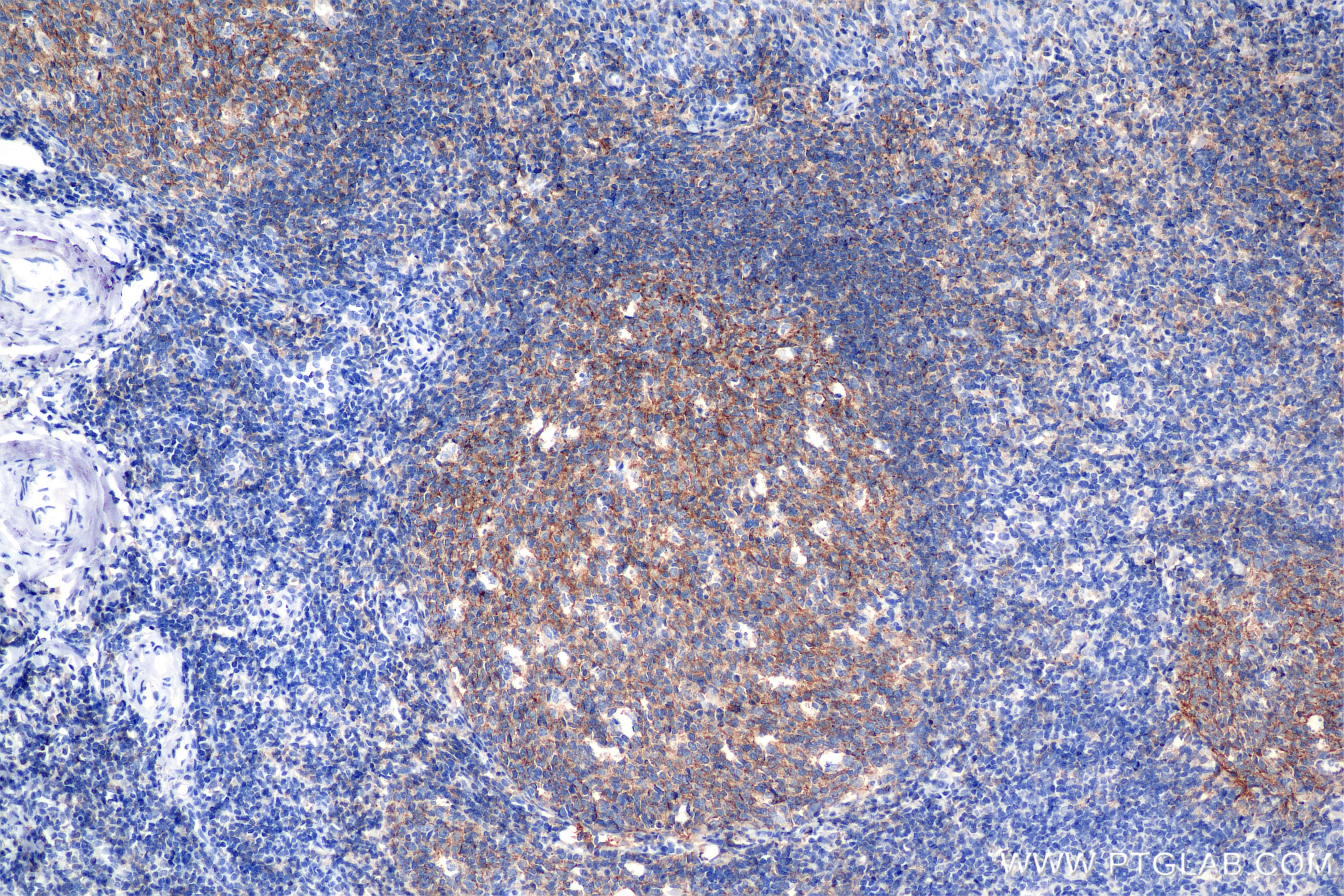 Immunohistochemistry (IHC) staining of human tonsil tissue using CD19 Recombinant antibody (86116-1-RR)