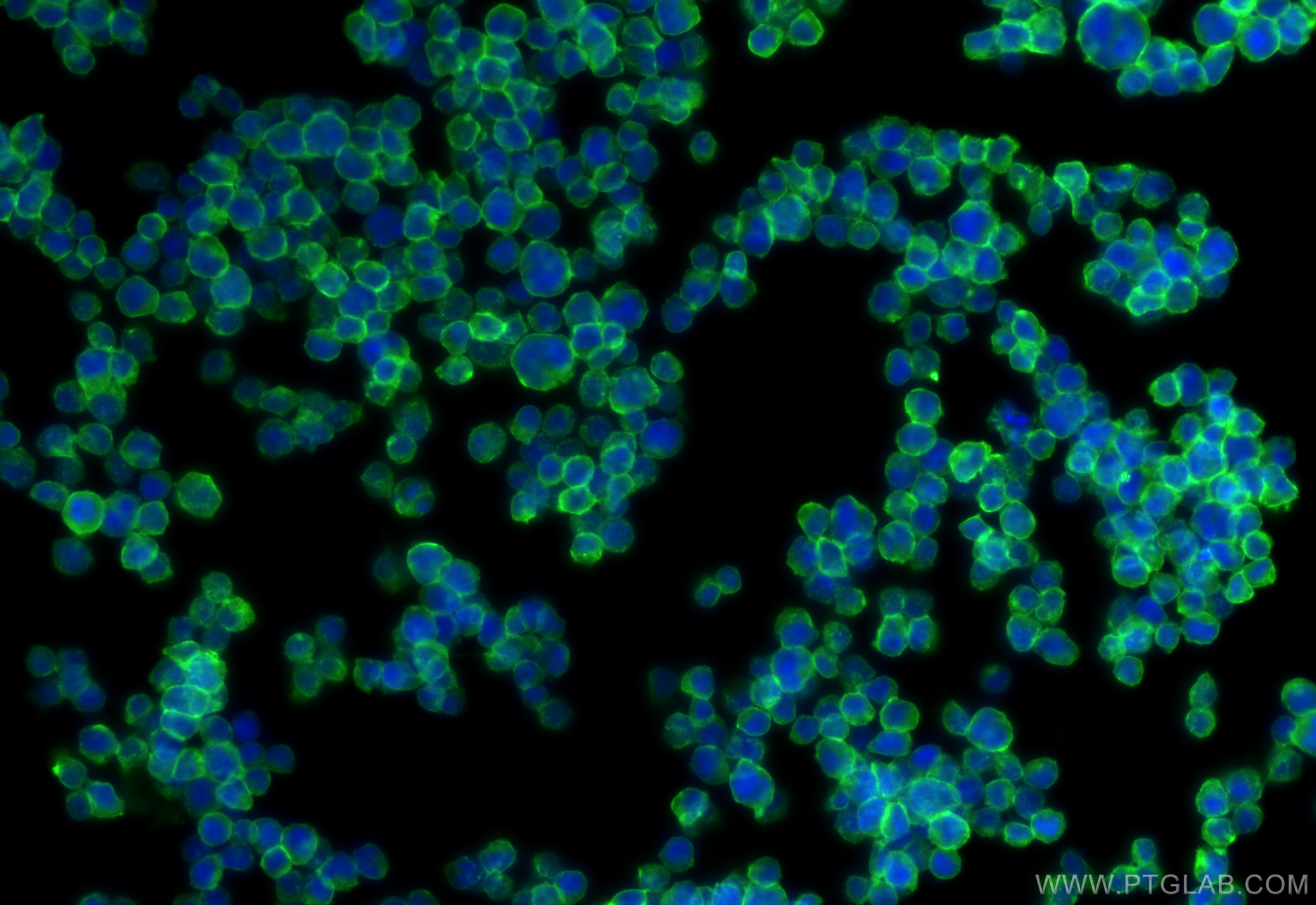 Immunofluorescence (IF) / fluorescent staining of Jurkat cells using CD2 Polyclonal antibody (31803-1-AP)