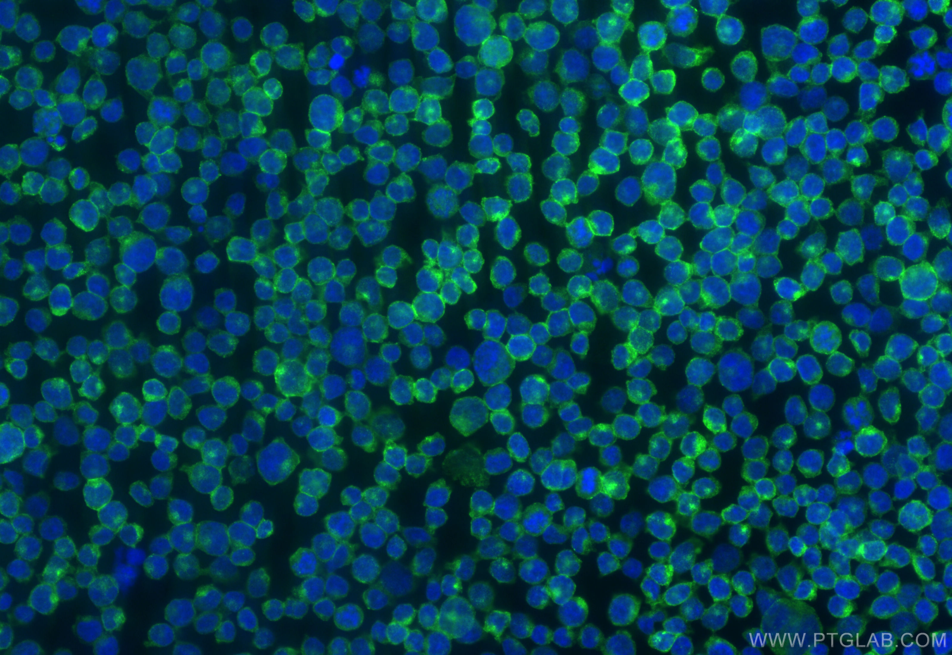 Immunofluorescence (IF) / fluorescent staining of Jurkat cells using CD2 Recombinant antibody (84108-3-RR)