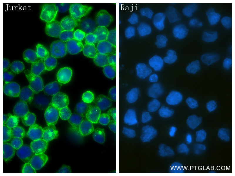 Immunofluorescence (IF) / fluorescent staining of Jurkat cells using CD2 Recombinant antibody (84108-5-RR)