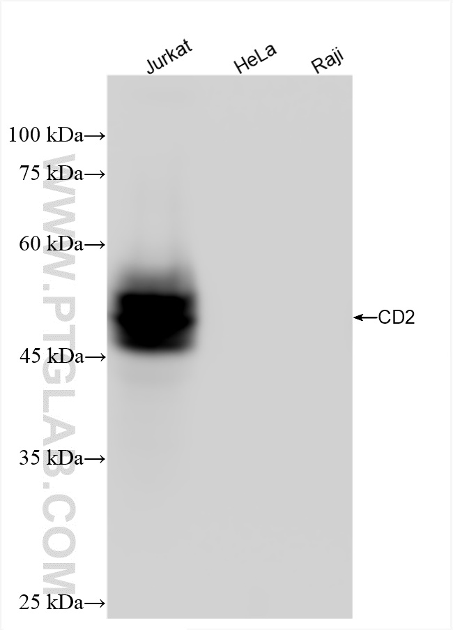 Western Blot (WB) analysis of various lysates using CD2 Recombinant antibody (84108-5-RR)