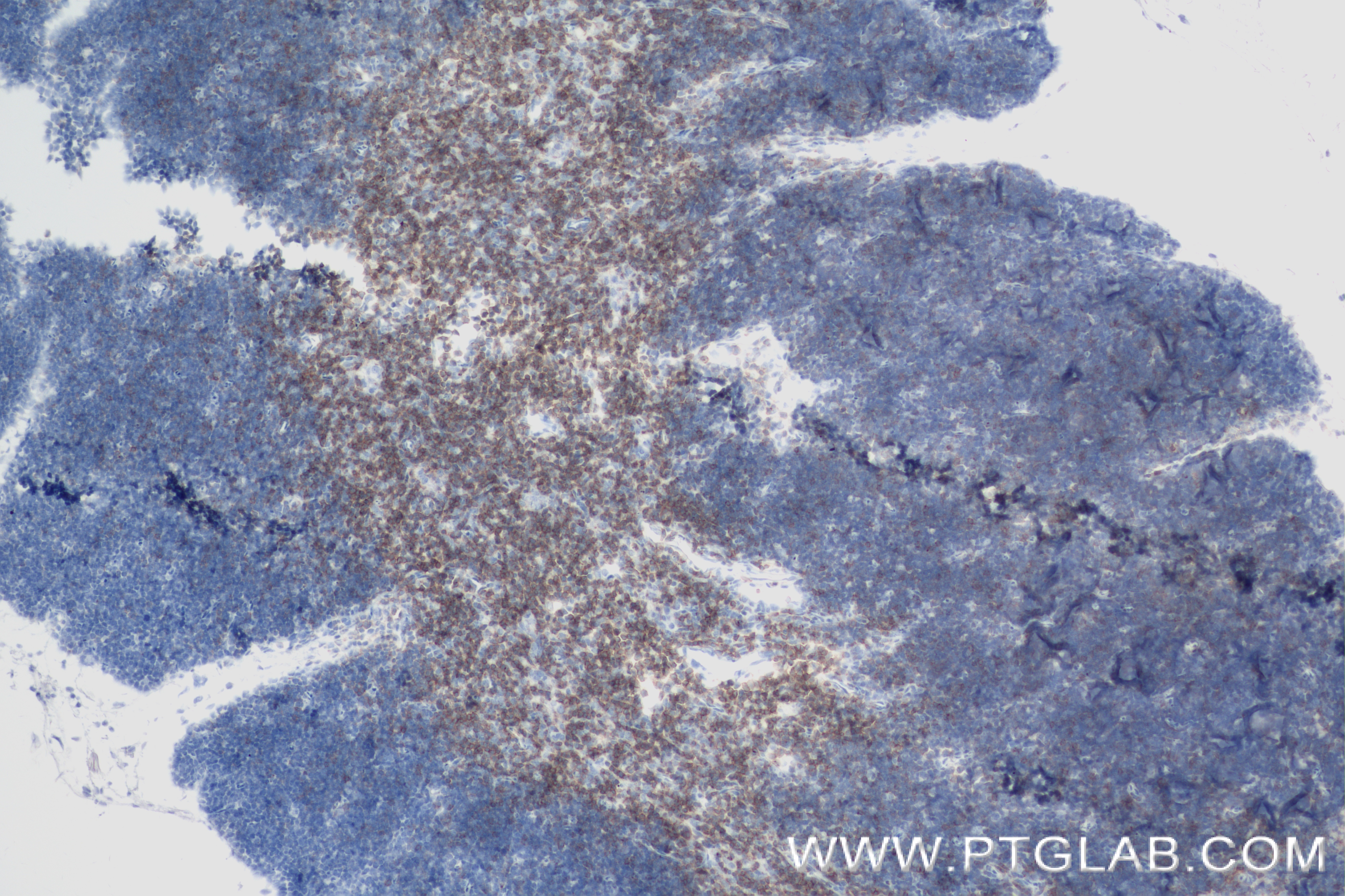 Immunohistochemistry (IHC) staining of mouse thymus tissue using CD2 Recombinant antibody (84360-4-RR)