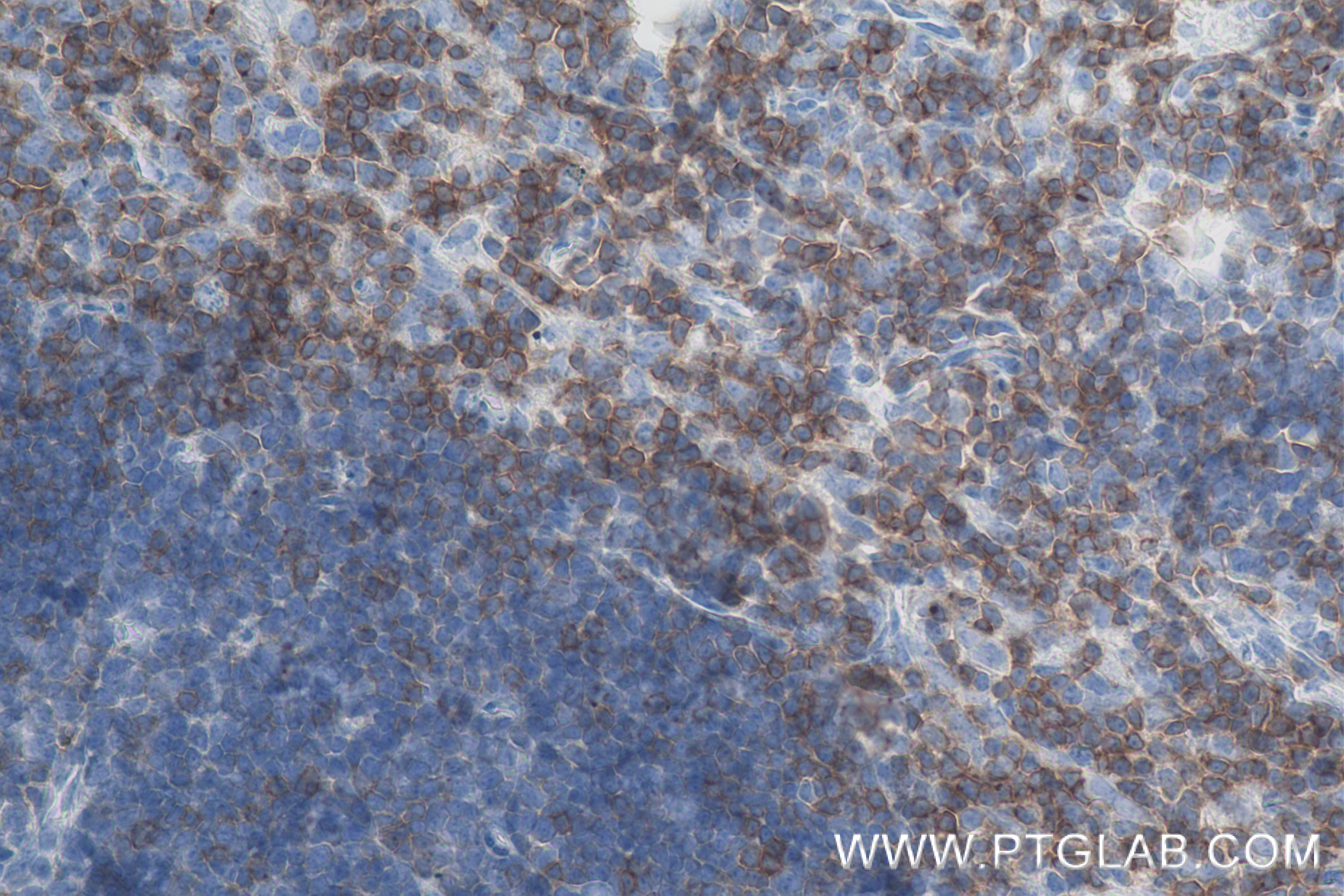 Immunohistochemistry (IHC) staining of mouse thymus tissue using CD2 Recombinant antibody (84360-4-RR)