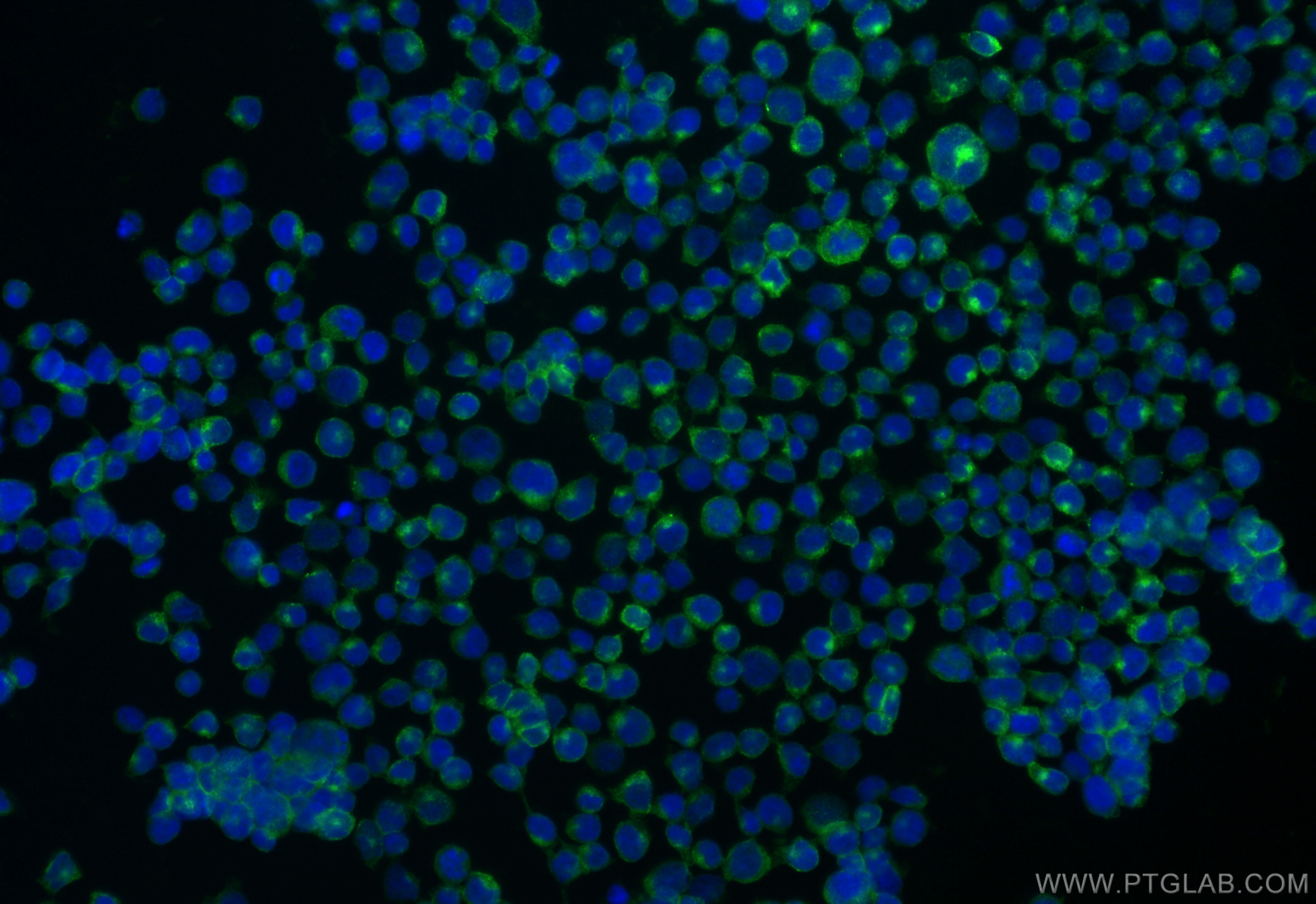 Immunofluorescence (IF) / fluorescent staining of Jurkat cells using CoraLite® Plus 488-conjugated CD2 Recombinant anti (CL488-84108-3)