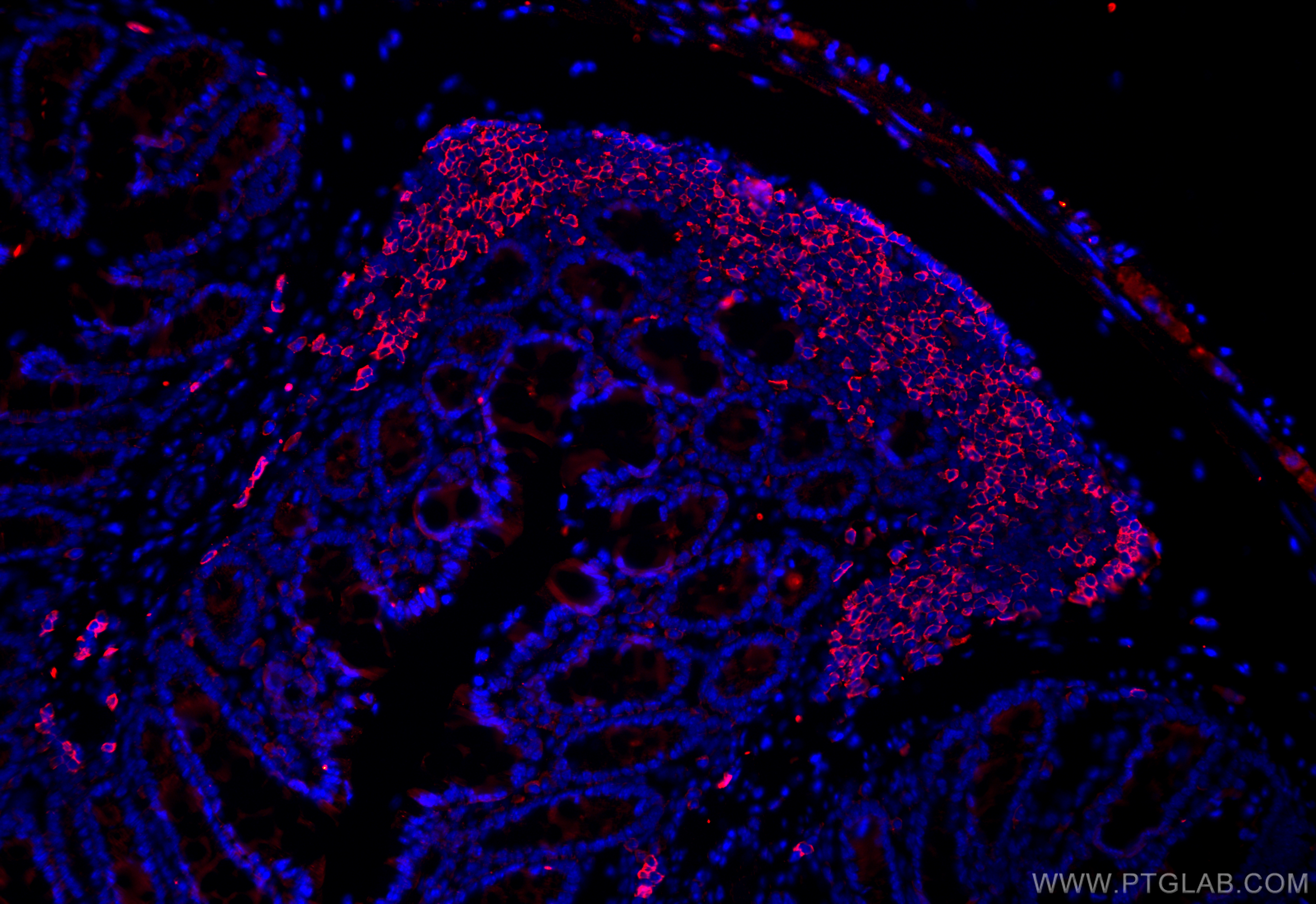 Immunofluorescence (IF) / fluorescent staining of mouse colon tissue using CD20 Polyclonal antibody (31909-1-AP)