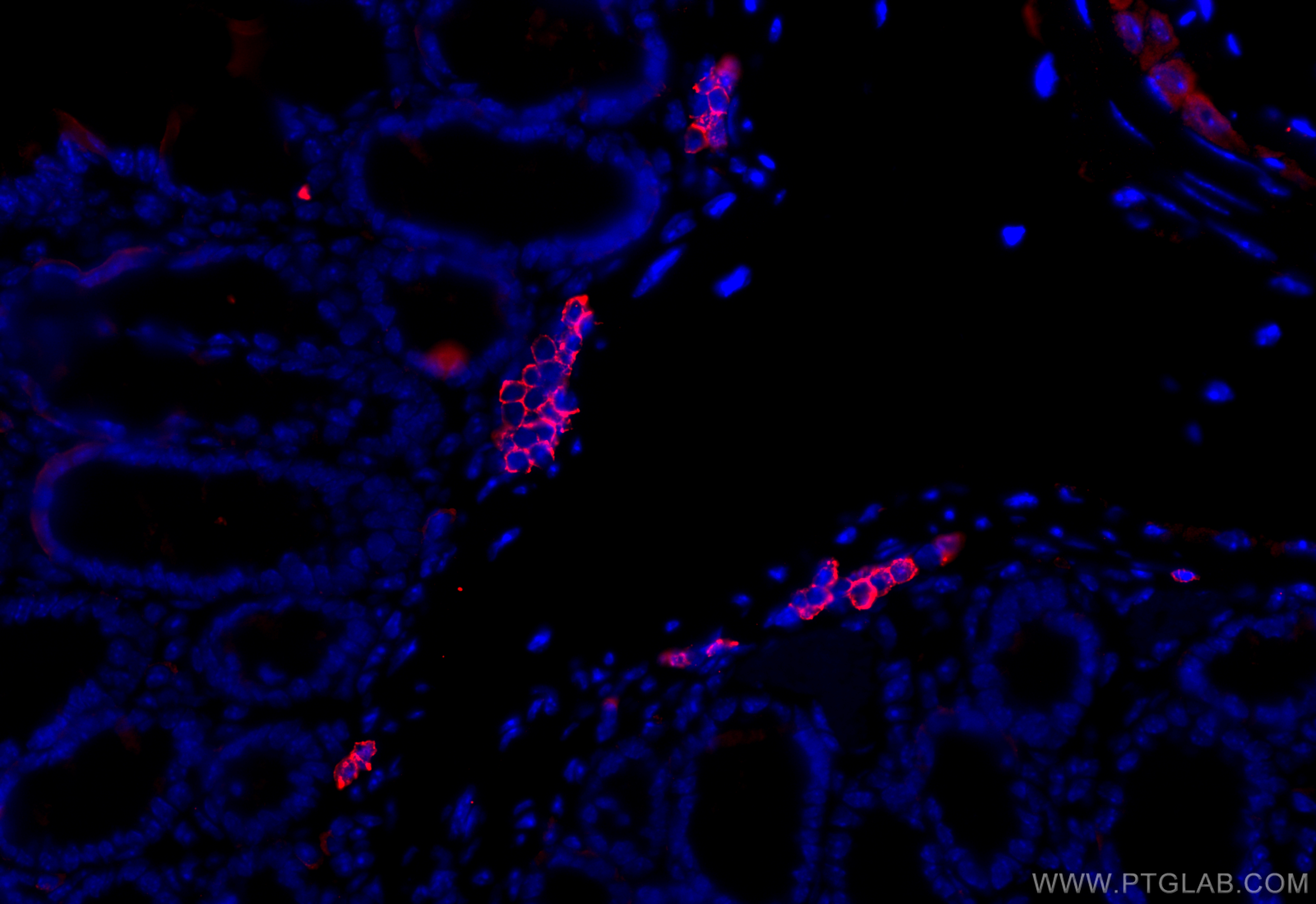 Immunofluorescence (IF) / fluorescent staining of mouse colon tissue using CD20 Polyclonal antibody (31909-1-AP)