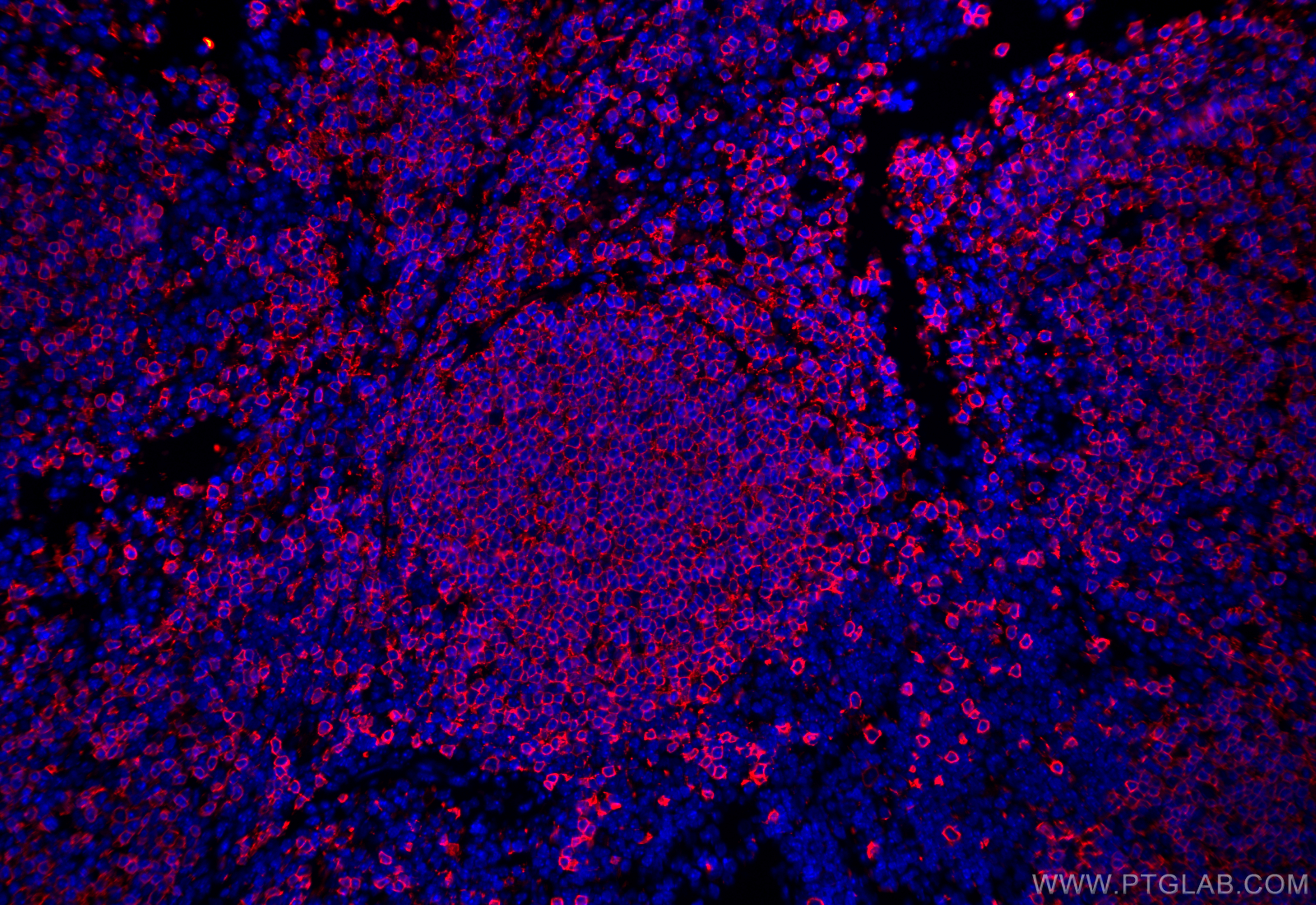 Immunofluorescence (IF) / fluorescent staining of mouse spleen tissue using CD20 Polyclonal antibody (31909-1-AP)