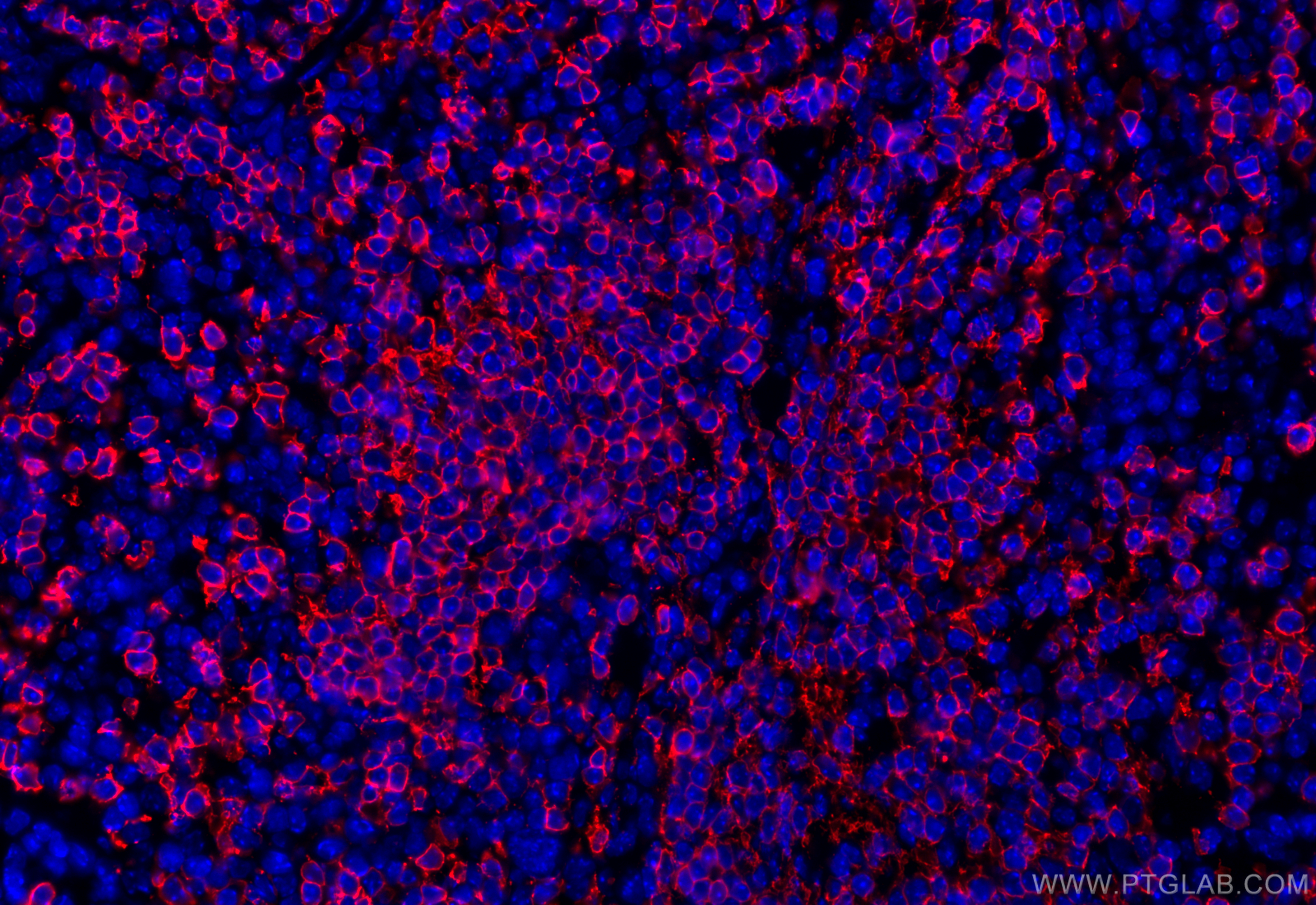 Immunofluorescence (IF) / fluorescent staining of mouse spleen tissue using CD20 Polyclonal antibody (31909-1-AP)