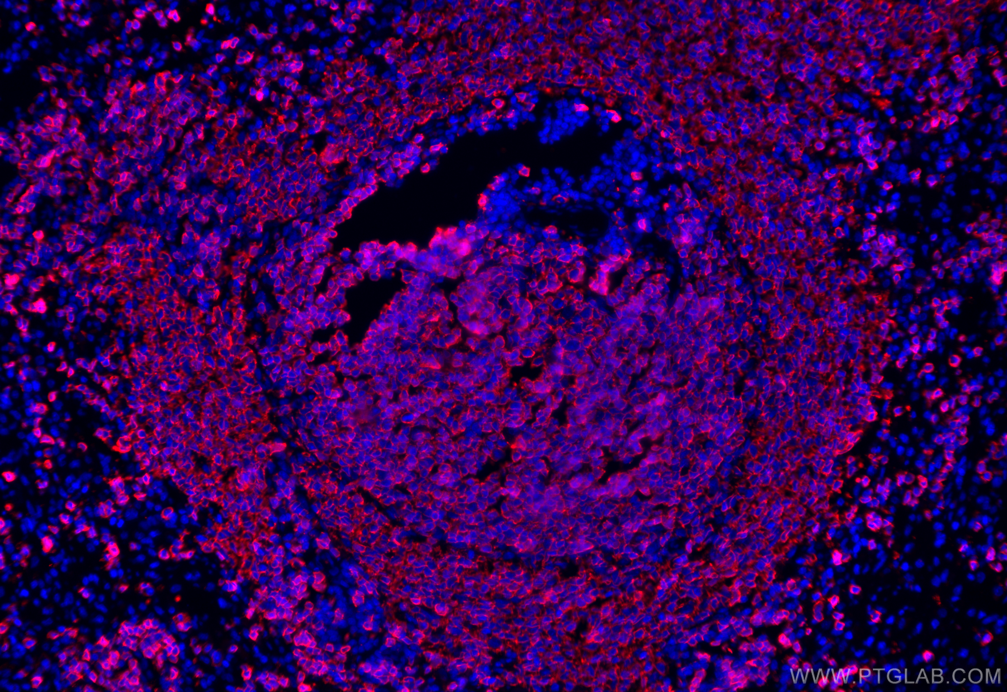 Immunofluorescence (IF) / fluorescent staining of rat spleen tissue using CD20 Polyclonal antibody (31909-1-AP)