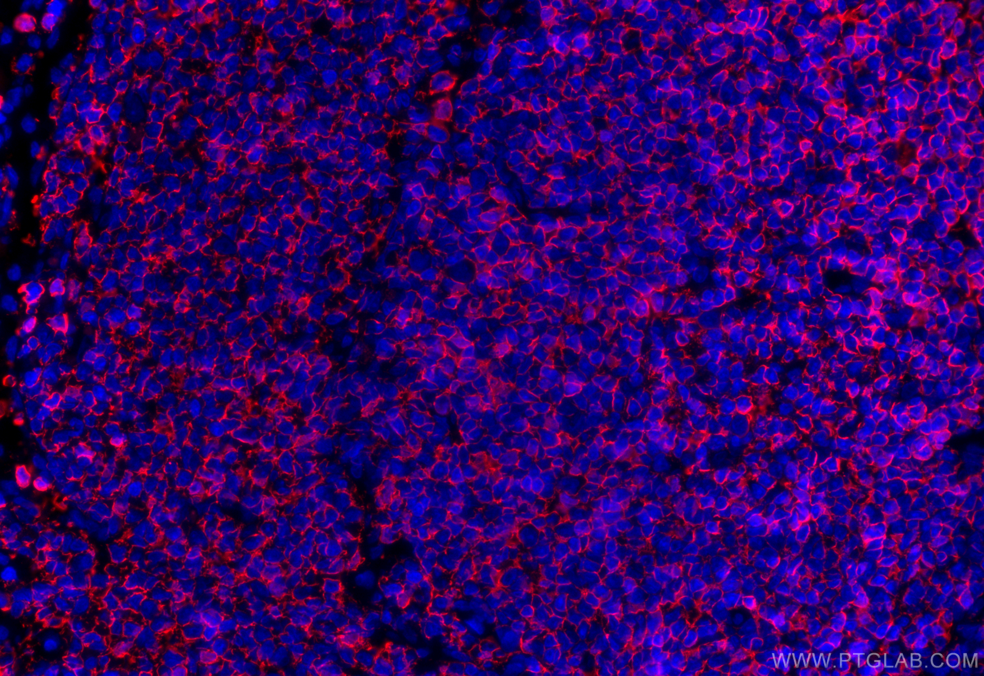 Immunofluorescence (IF) / fluorescent staining of rat spleen tissue using CD20 Polyclonal antibody (31909-1-AP)