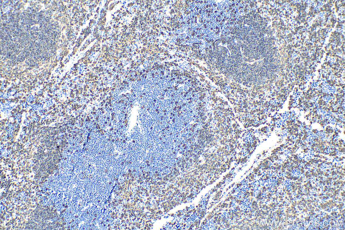 Immunohistochemistry (IHC) staining of mouse spleen tissue using CD20 Polyclonal antibody (31909-1-AP)