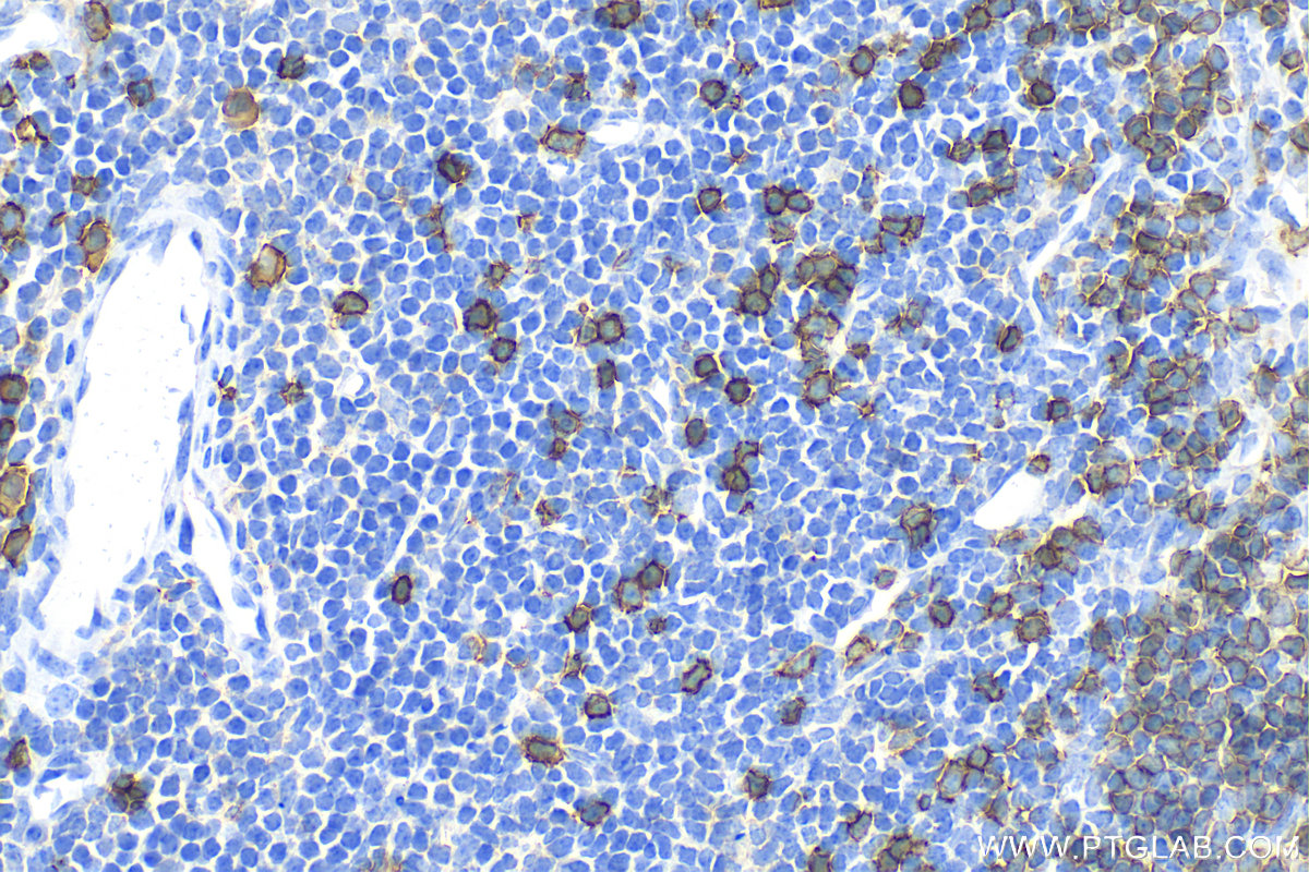 Immunohistochemistry (IHC) staining of mouse spleen tissue using CD20 Polyclonal antibody (31909-1-AP)