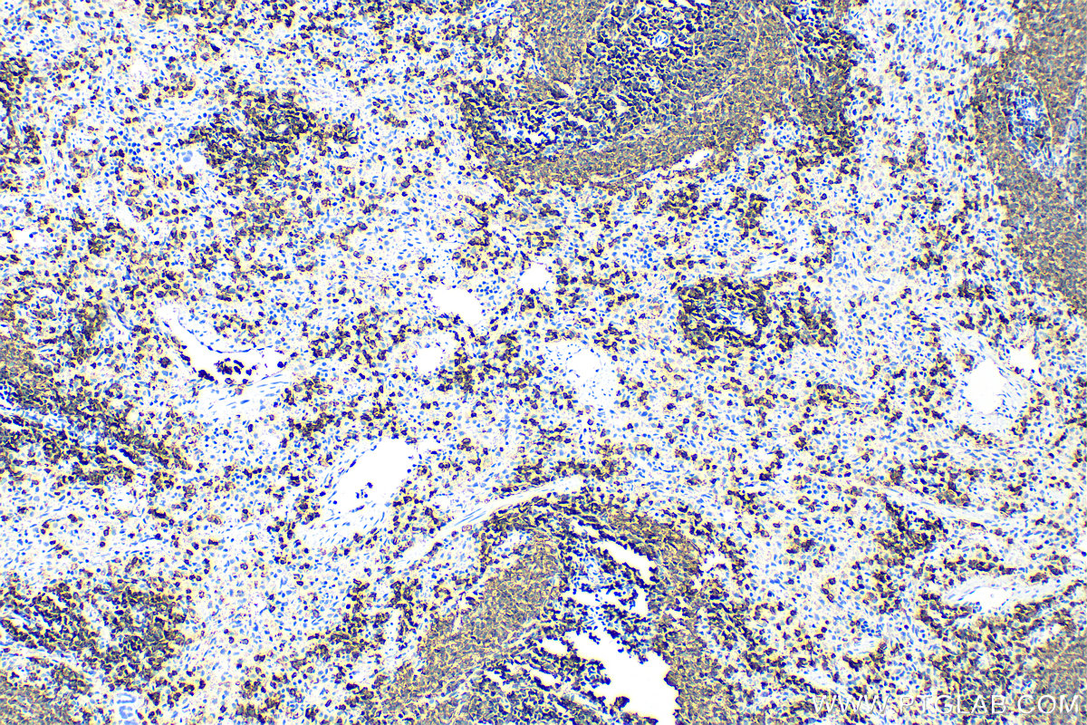 Immunohistochemistry (IHC) staining of rat spleen tissue using CD20 Polyclonal antibody (31909-1-AP)