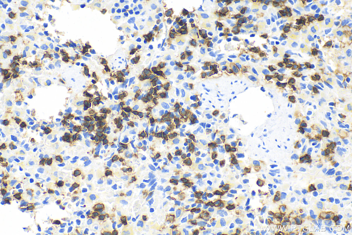 Immunohistochemistry (IHC) staining of rat spleen tissue using CD20 Polyclonal antibody (31909-1-AP)