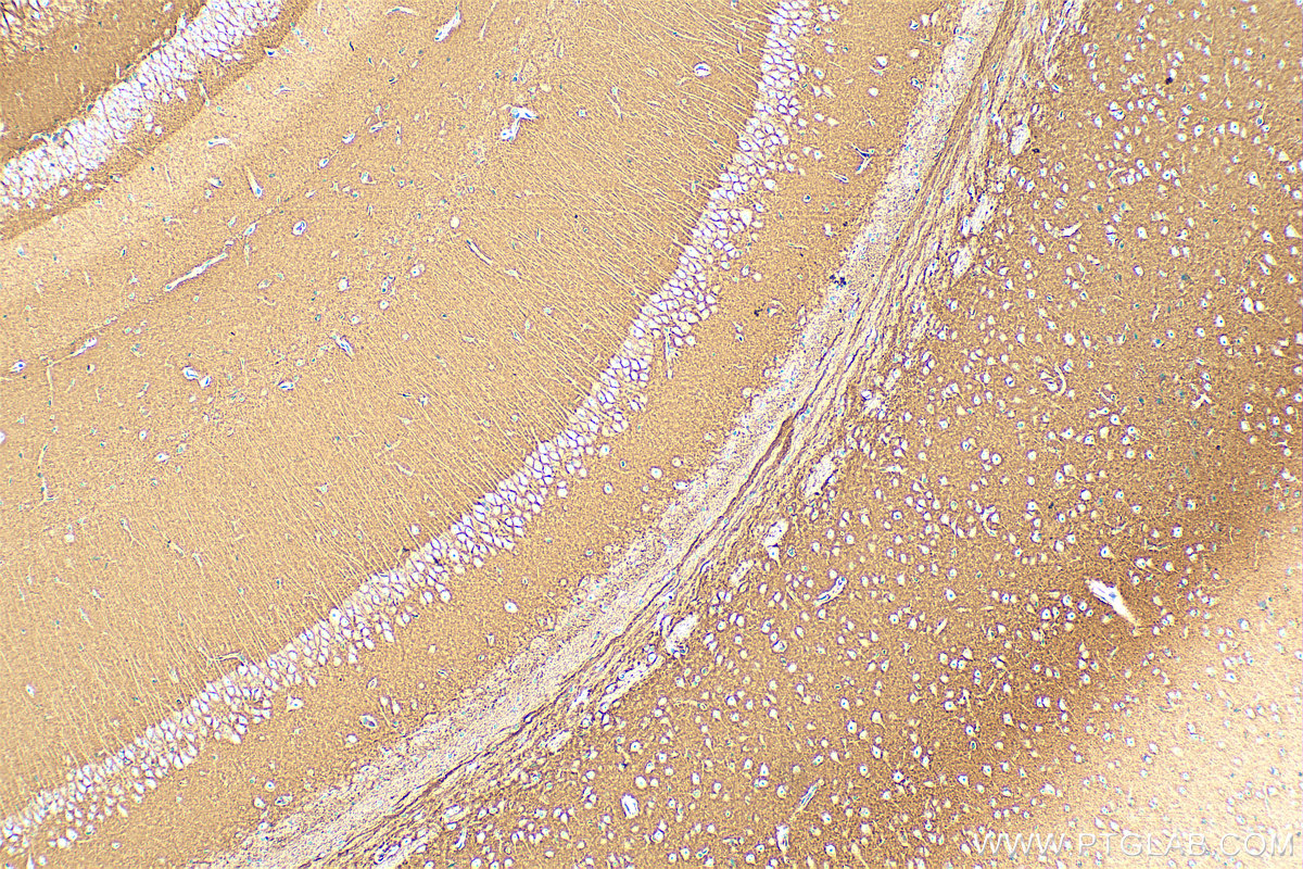 Immunohistochemistry (IHC) staining of mouse brain tissue using CD200 Polyclonal antibody (31444-1-AP)