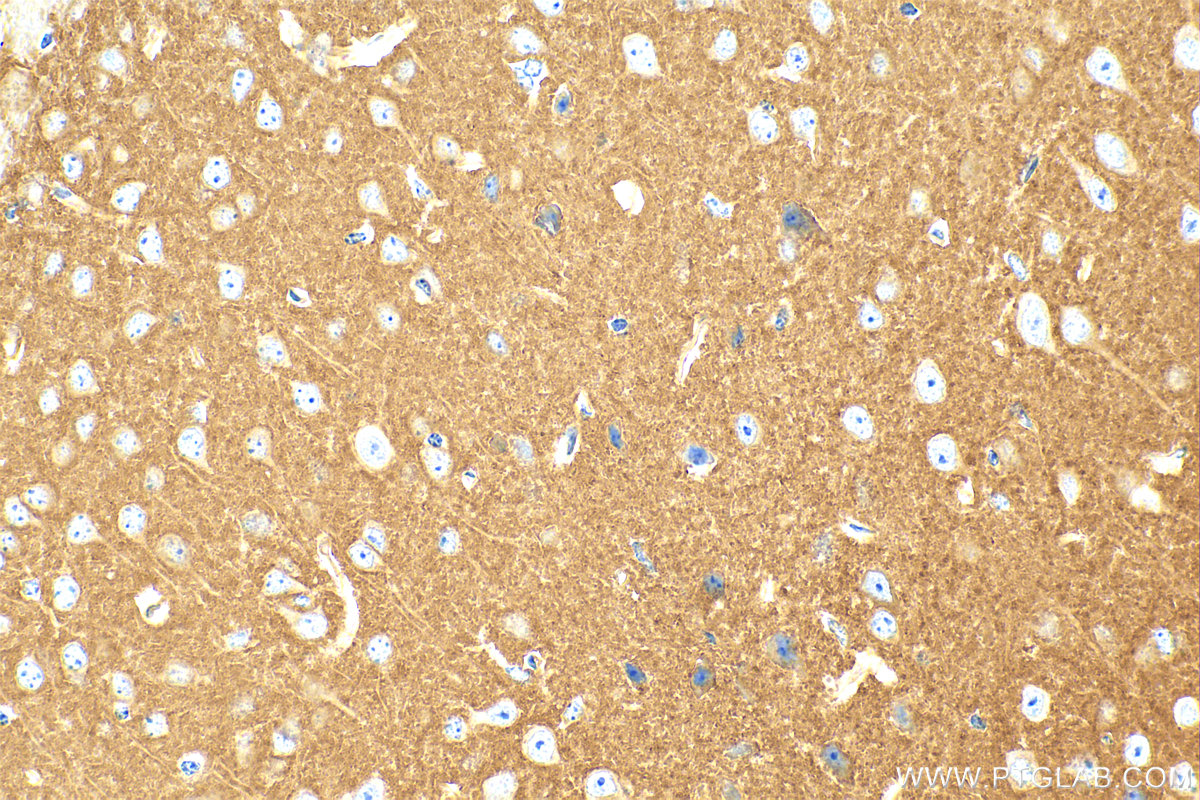 Immunohistochemistry (IHC) staining of mouse brain tissue using CD200 Polyclonal antibody (31444-1-AP)