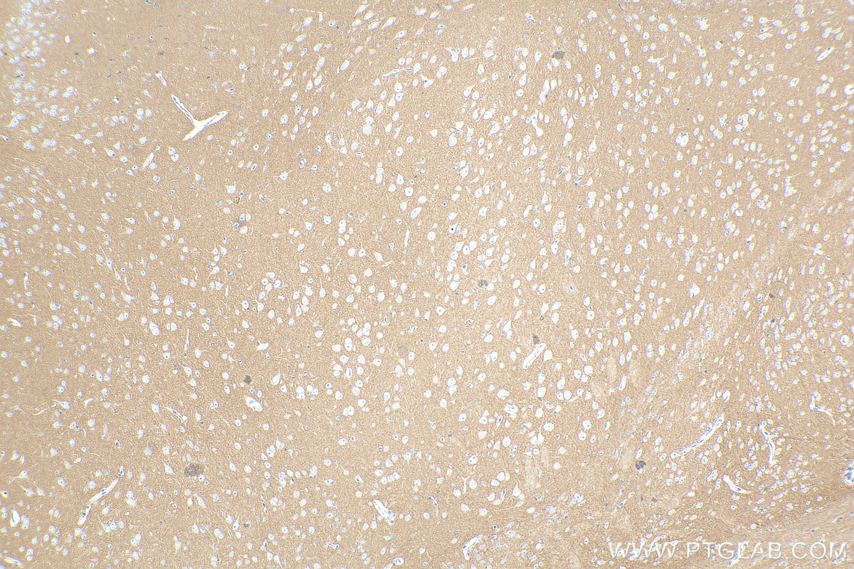 Immunohistochemistry (IHC) staining of mouse brain tissue using CD200 Recombinant antibody (83437-5-RR)