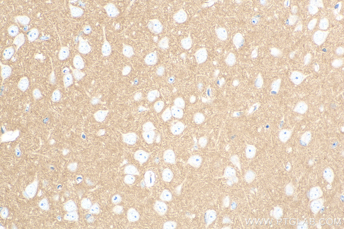 Immunohistochemistry (IHC) staining of mouse brain tissue using CD200 Recombinant antibody (83437-5-RR)