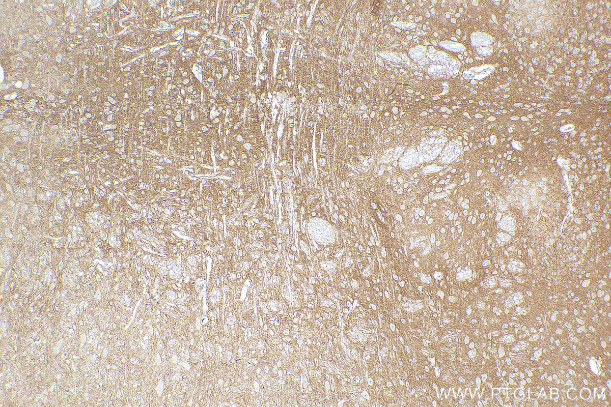 Immunohistochemistry (IHC) staining of mouse cerebellum tissue using CD200 Recombinant antibody (83437-5-RR)