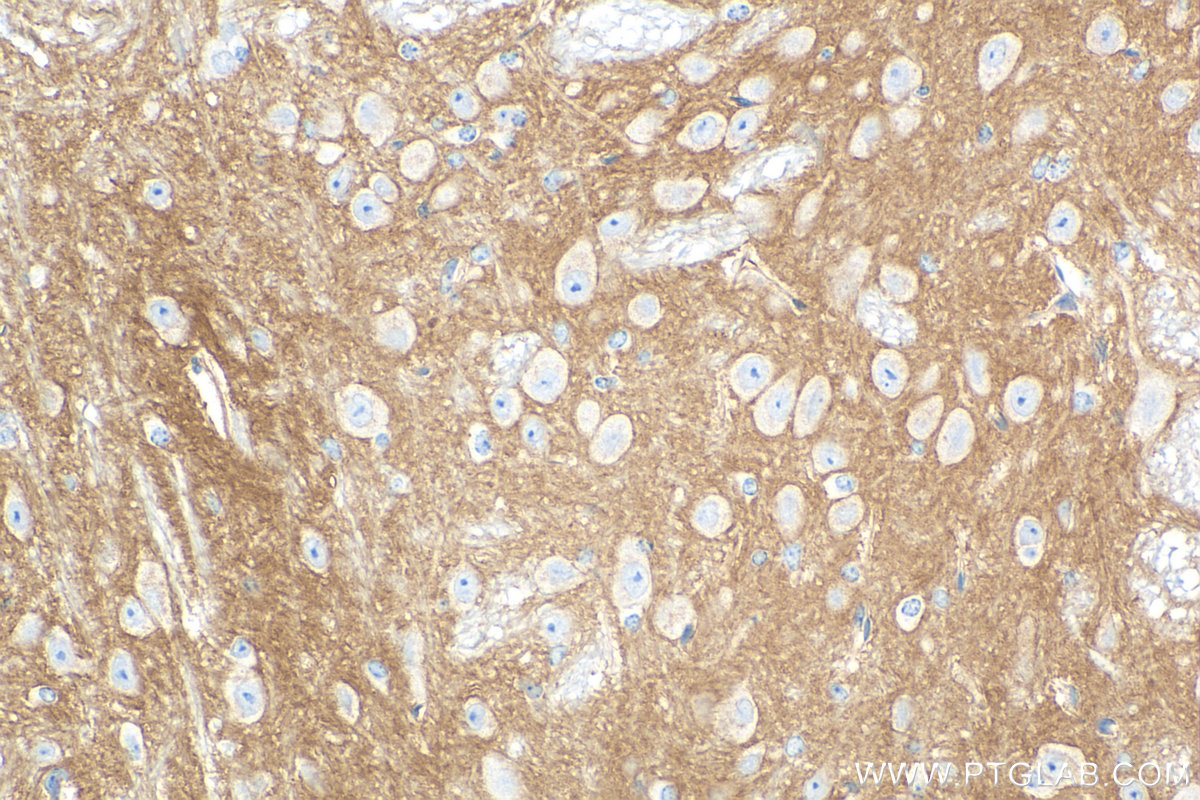 Immunohistochemistry (IHC) staining of mouse cerebellum tissue using CD200 Recombinant antibody (83437-5-RR)