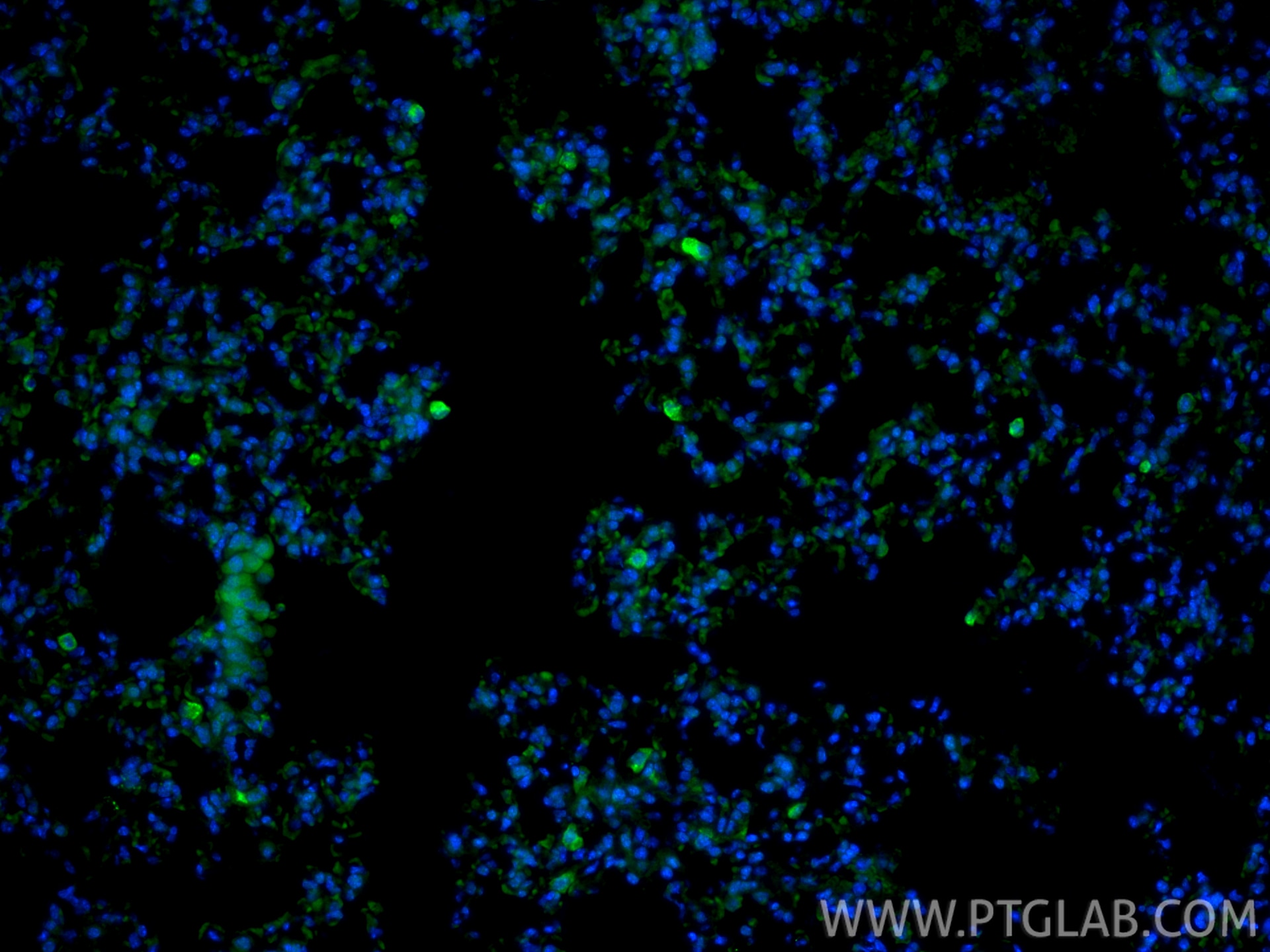 Immunofluorescence (IF) / fluorescent staining of mouse lung tissue using CD206 Recombinant monoclonal antibody (83485-1-RR)