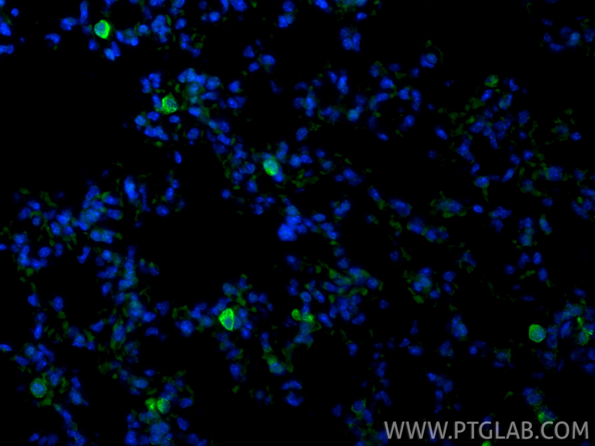Immunofluorescence (IF) / fluorescent staining of mouse lung tissue using CD206 Recombinant monoclonal antibody (83485-1-RR)