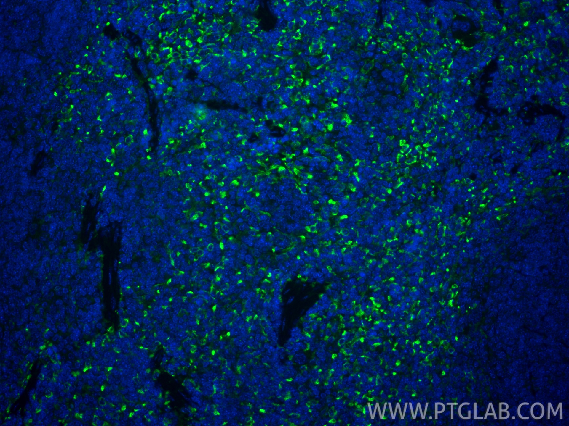 Immunofluorescence (IF) / fluorescent staining of mouse spleen tissue using CD206 Recombinant monoclonal antibody (83485-1-RR)