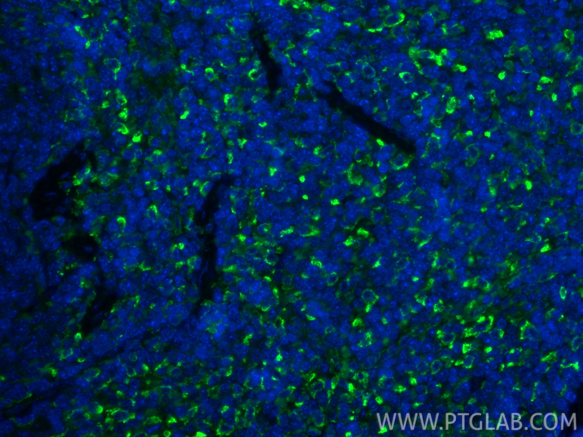 Immunofluorescence (IF) / fluorescent staining of mouse spleen tissue using CD206 Recombinant monoclonal antibody (83485-1-RR)