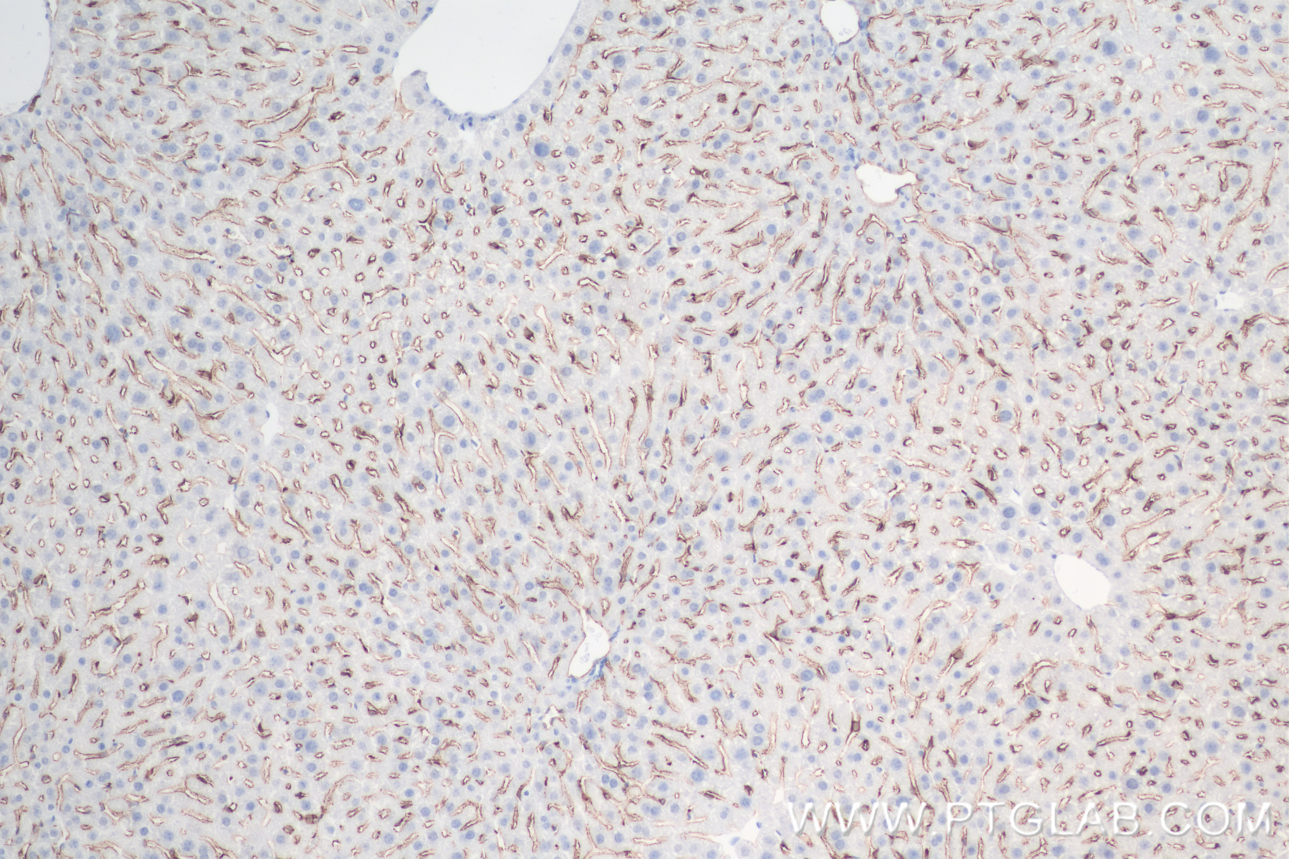 Immunohistochemistry (IHC) staining of mouse liver tissue using CD206 Recombinant antibody (83485-1-RR)