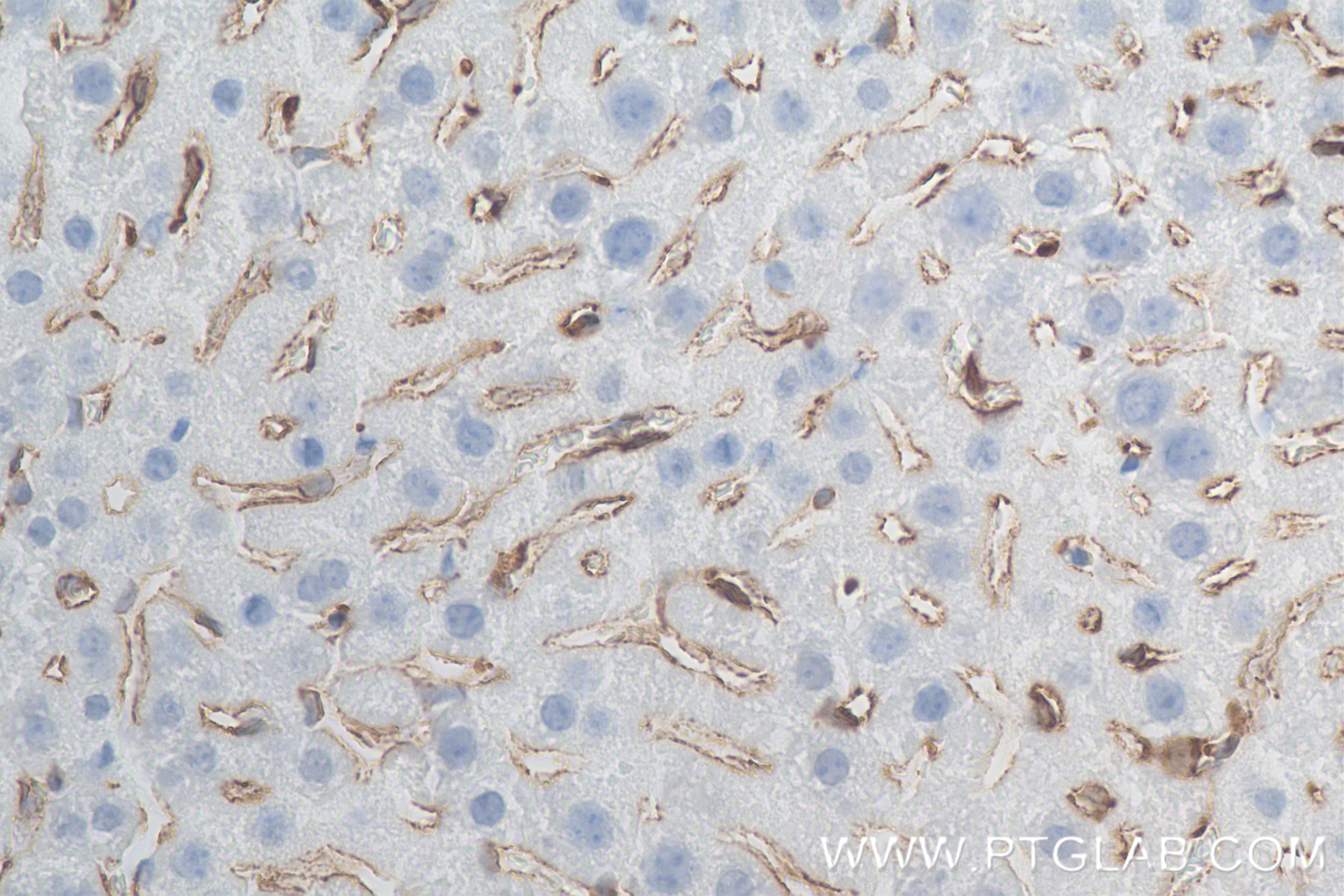 Immunohistochemistry (IHC) staining of mouse liver tissue using CD206 Recombinant monoclonal antibody (83485-1-RR)