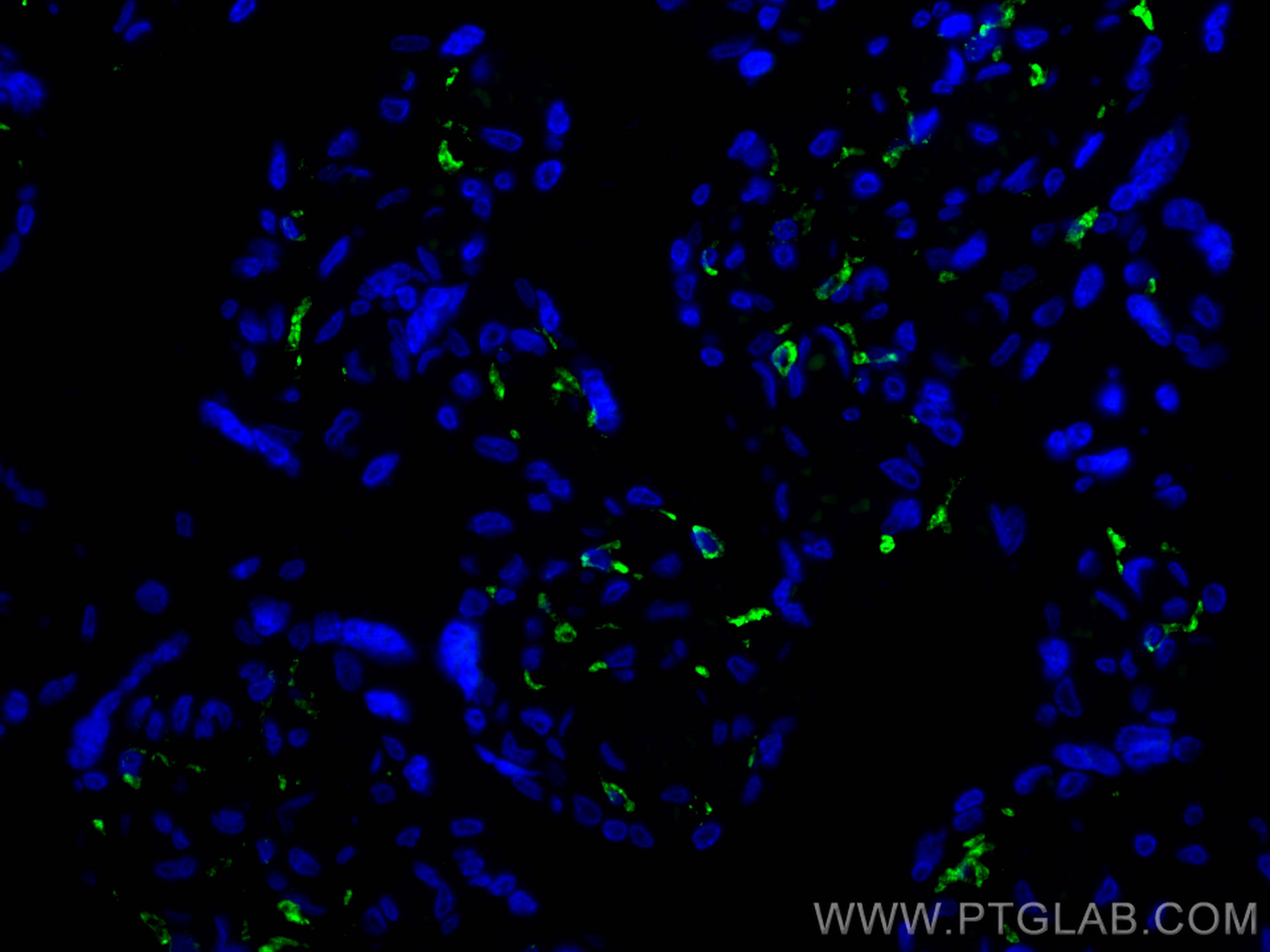Immunofluorescence (IF) / fluorescent staining of human placenta tissue using CoraLite® Plus 488-conjugated CD206 Recombinant an (CL488-81525)