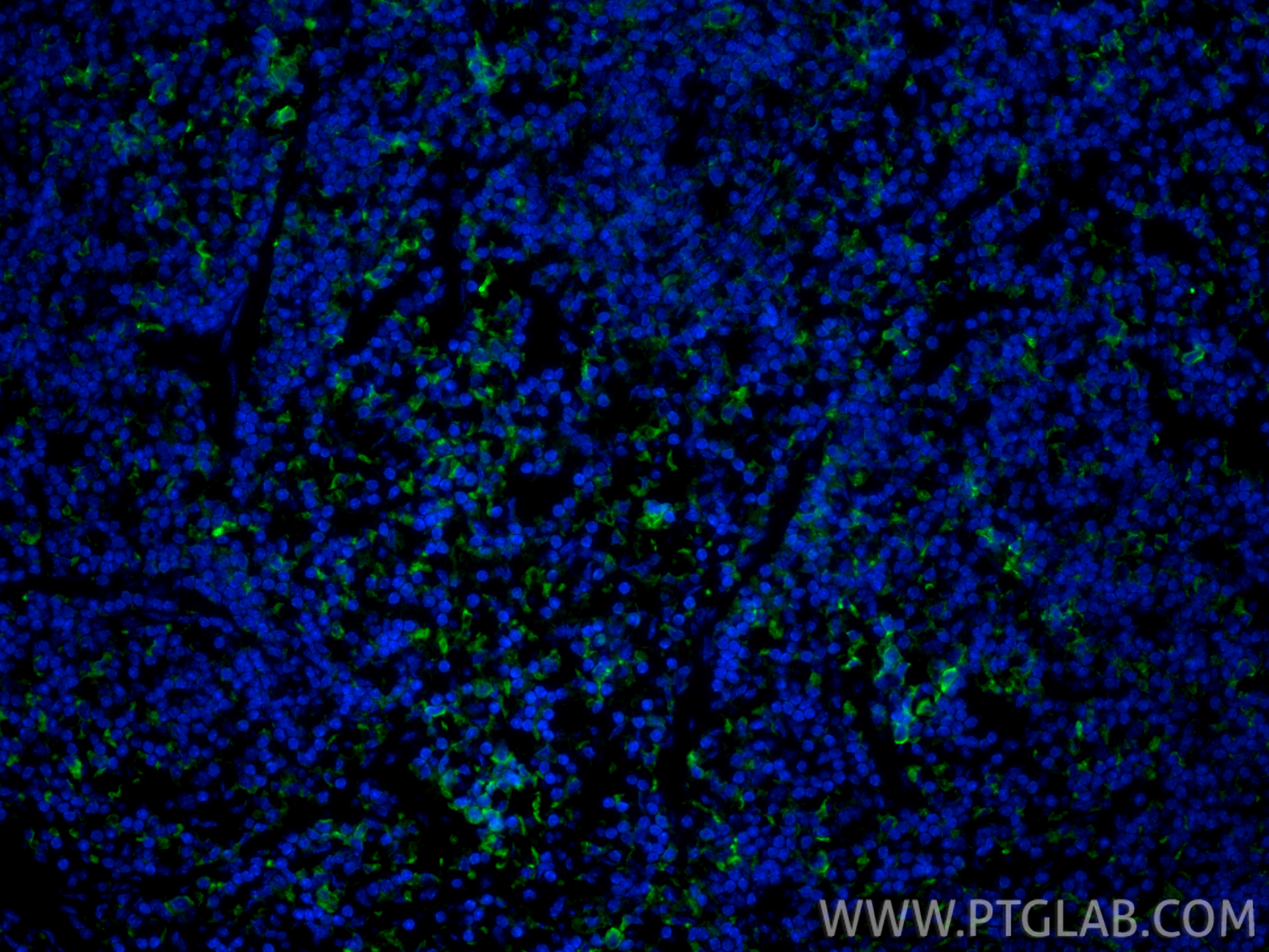 Immunofluorescence (IF) / fluorescent staining of mouse spleen tissue using CoraLite® Plus 488-conjugated CD206 Recombinant mo (CL488-83485)