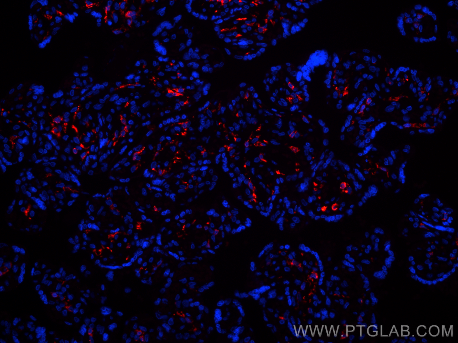 Immunofluorescence (IF) / fluorescent staining of human placenta tissue using CoraLite®594-conjugated CD206 Recombinant antibody (CL594-81525)